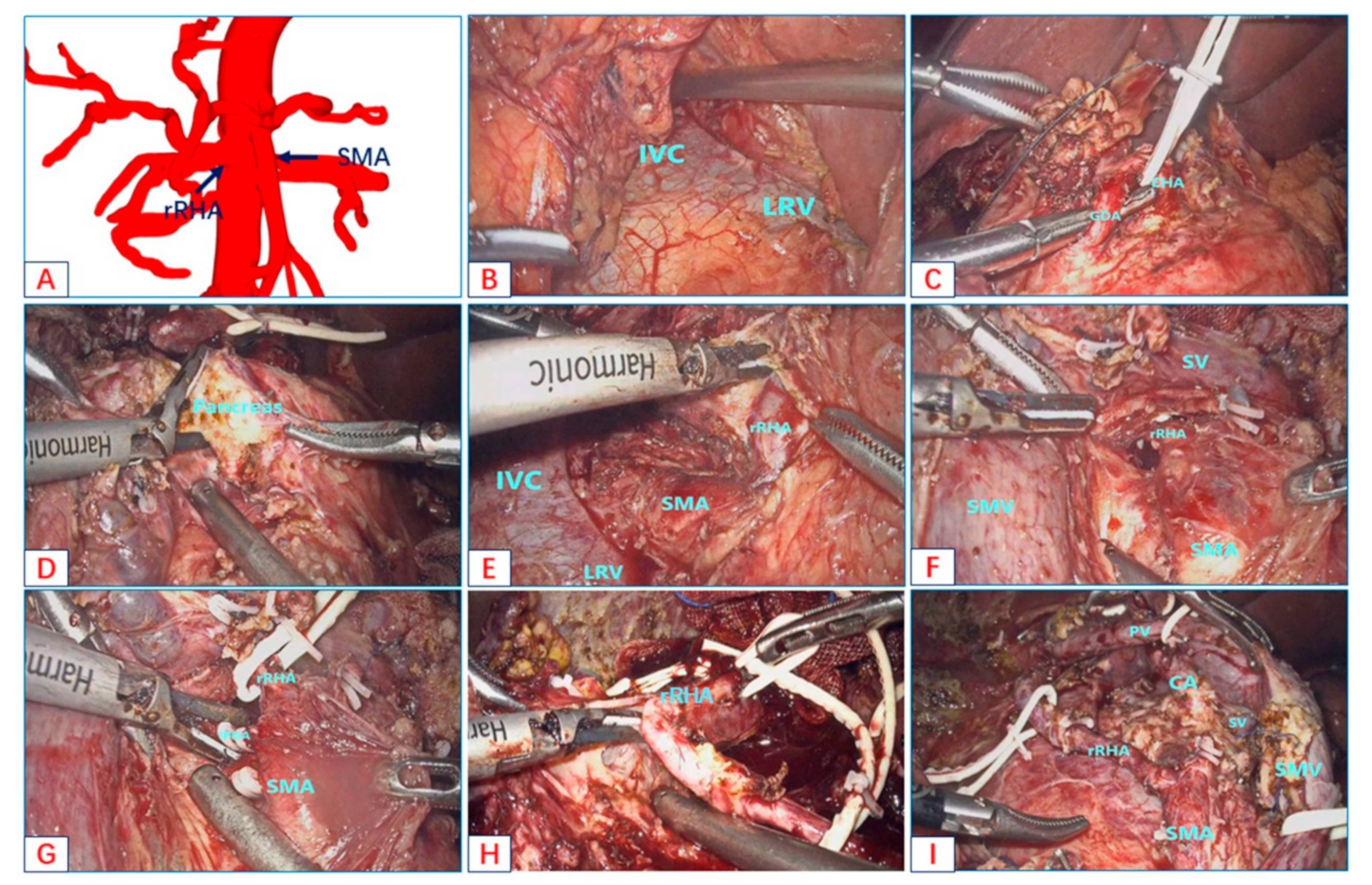 Jcm 12 01965 g004 Jcm 12 01965 g004