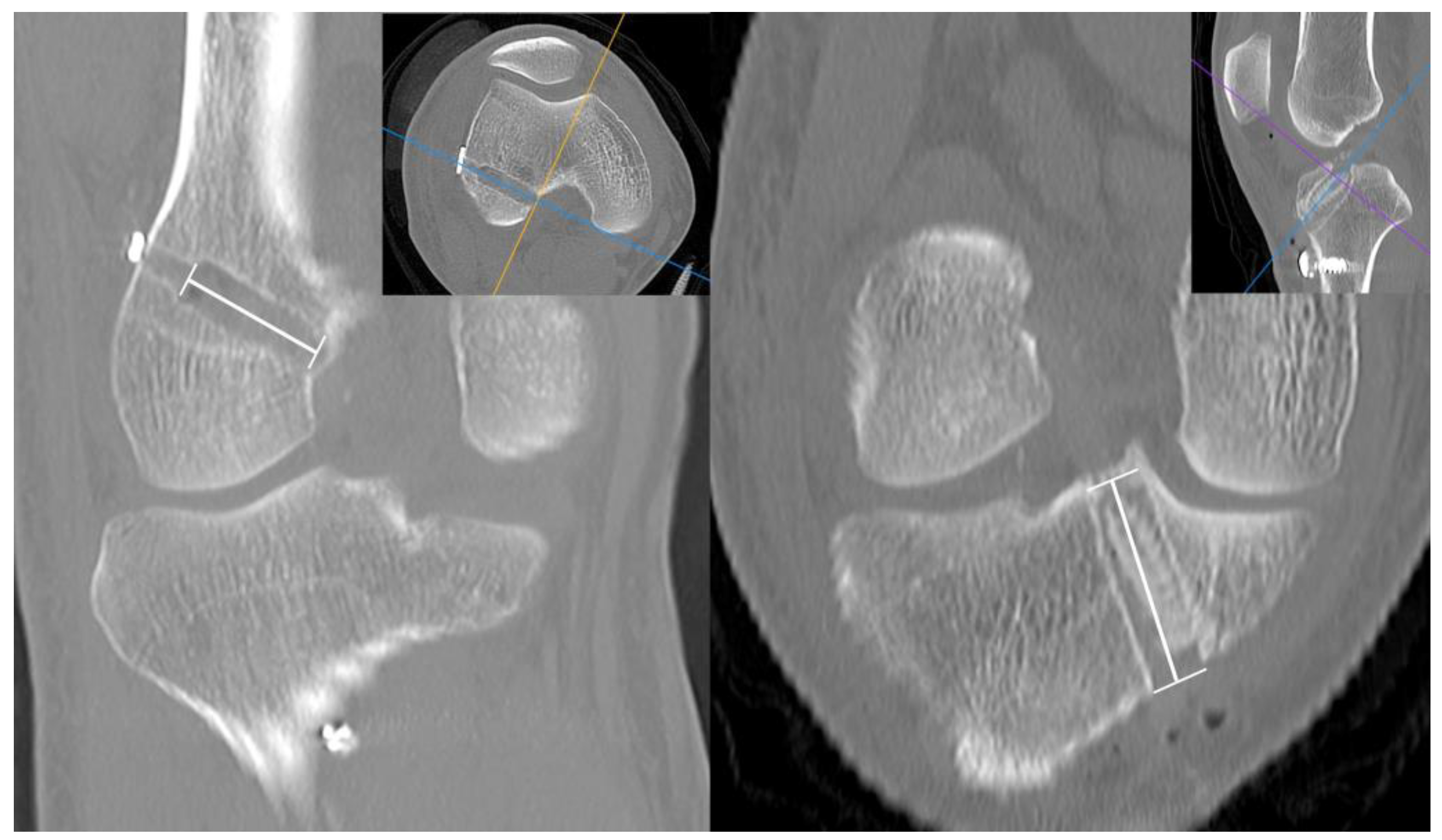 Jcm 12 01966 g006 Jcm 12 01966 g006
