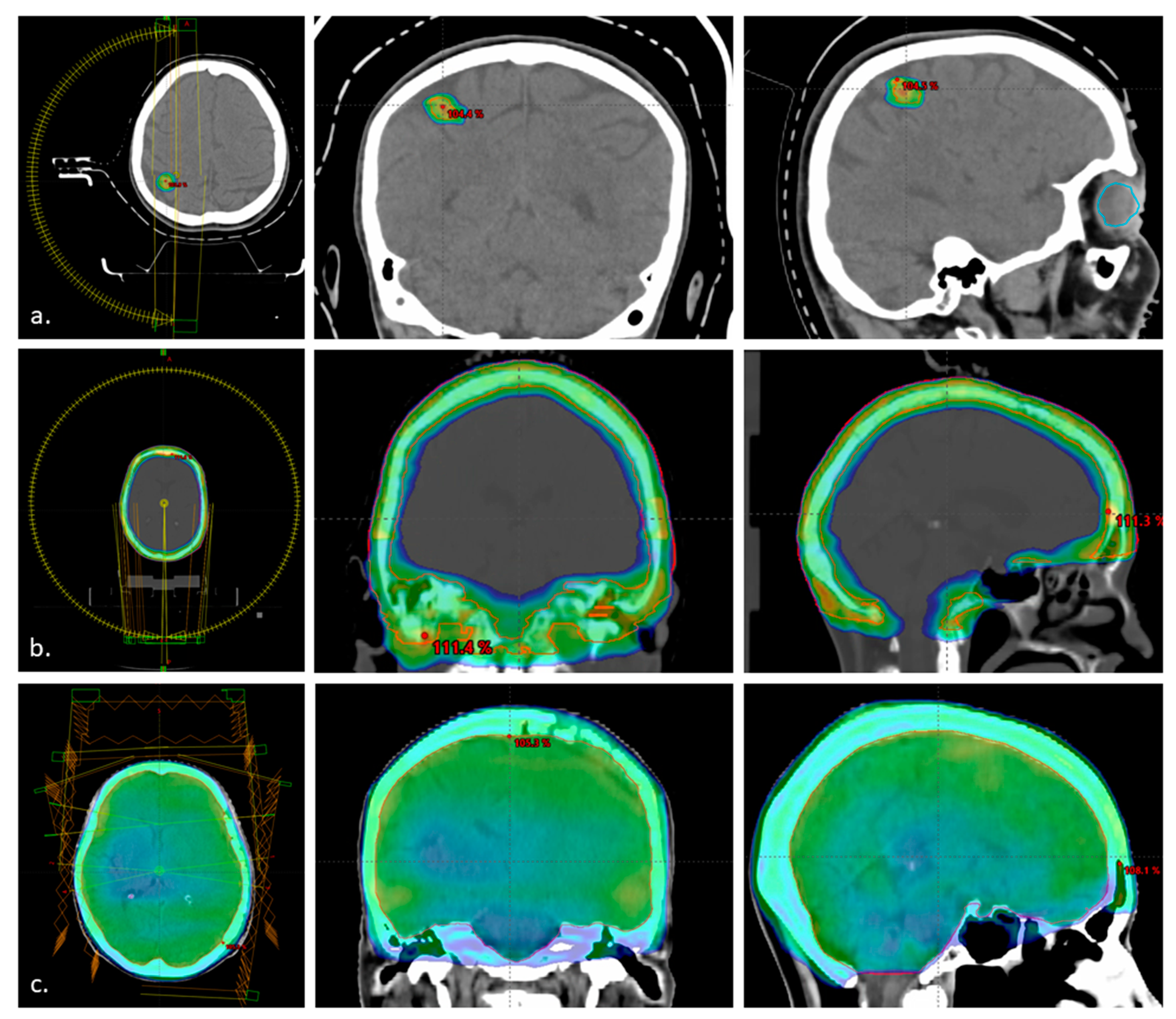 Jcm 12 02044 g001 Jcm 12 02044 g001