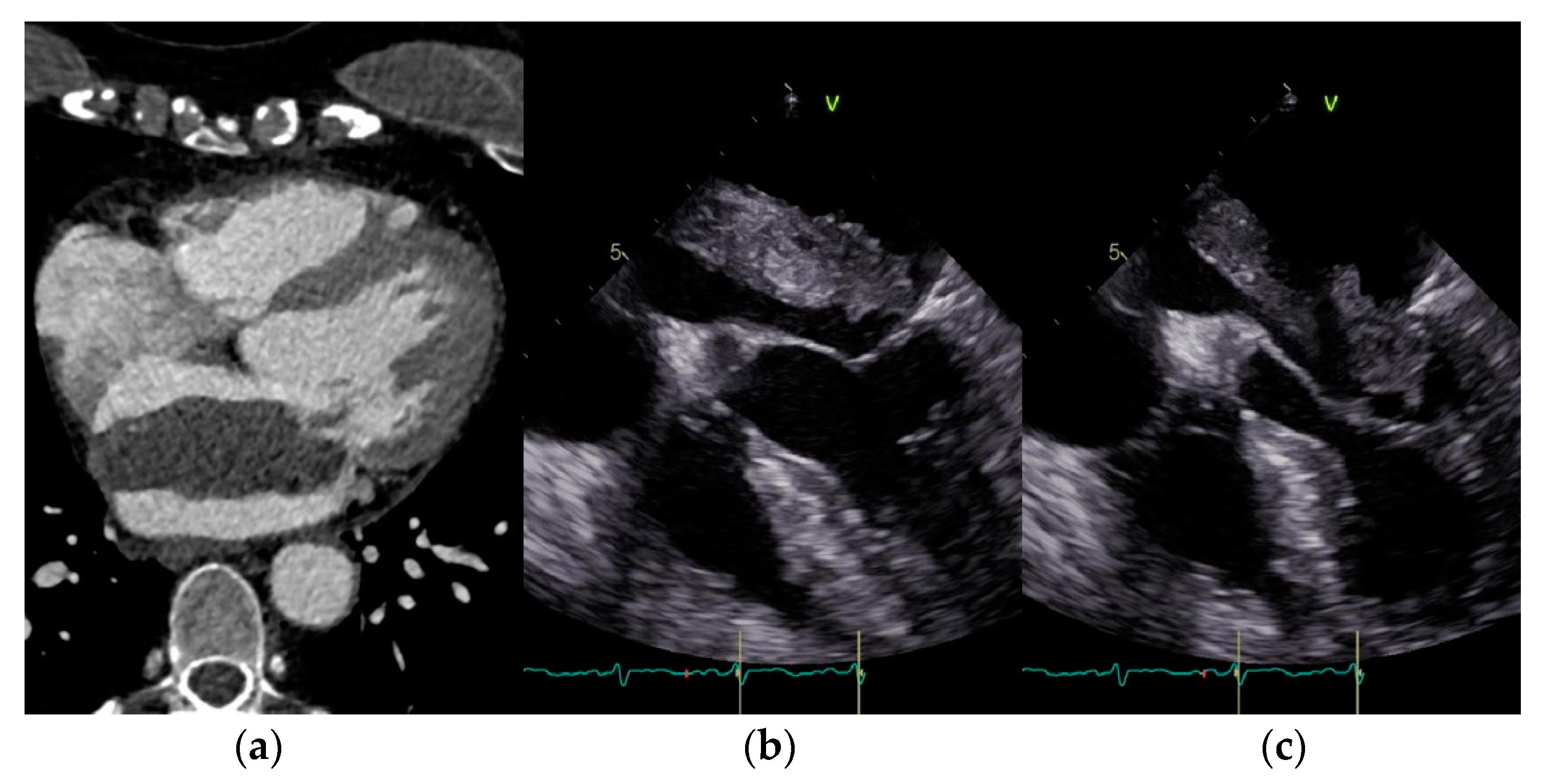 Jcm 12 02075 g001 Jcm 12 02075 g001