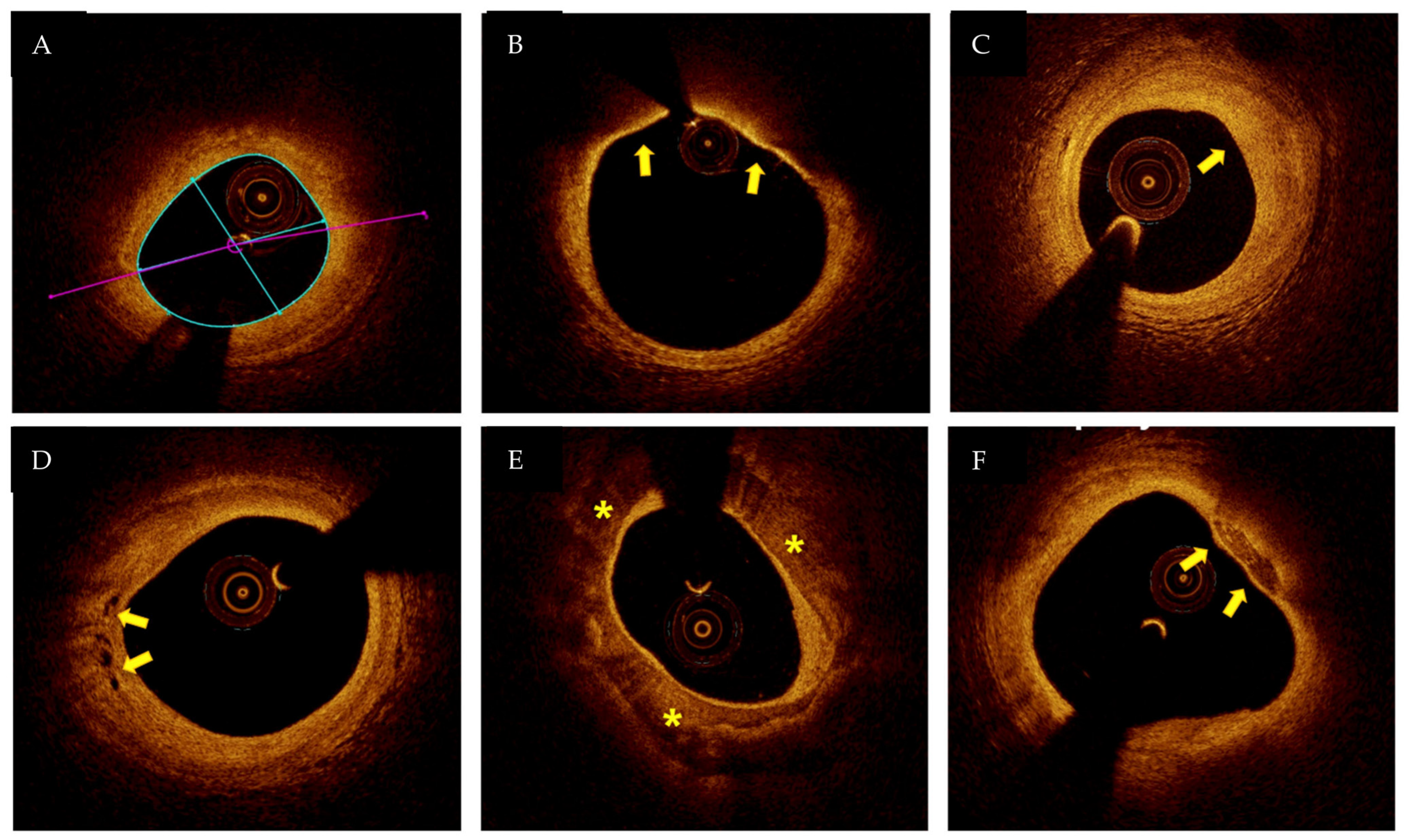 Jcm 12 02129 g001 Jcm 12 02129 g001