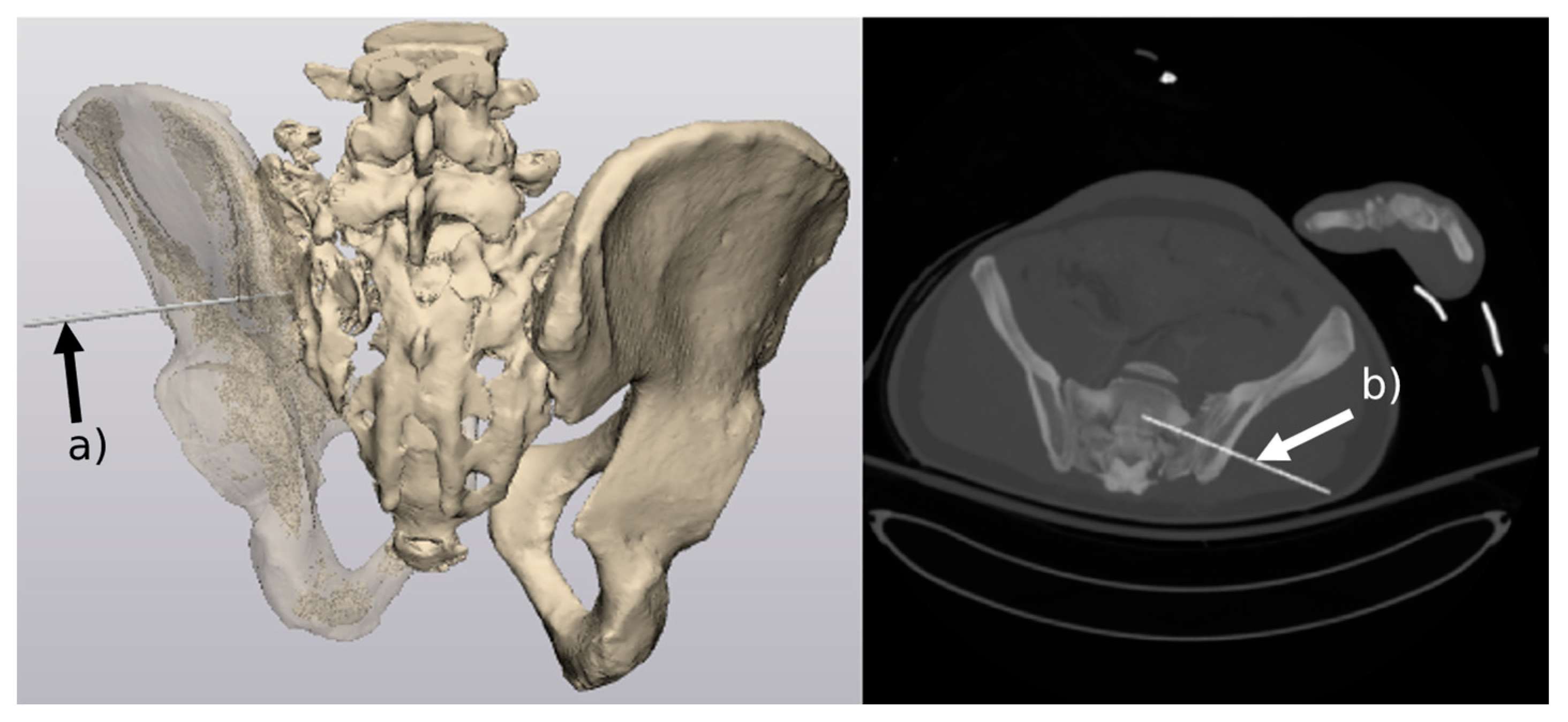 Jcm 12 02138 g003 Jcm 12 02138 g003