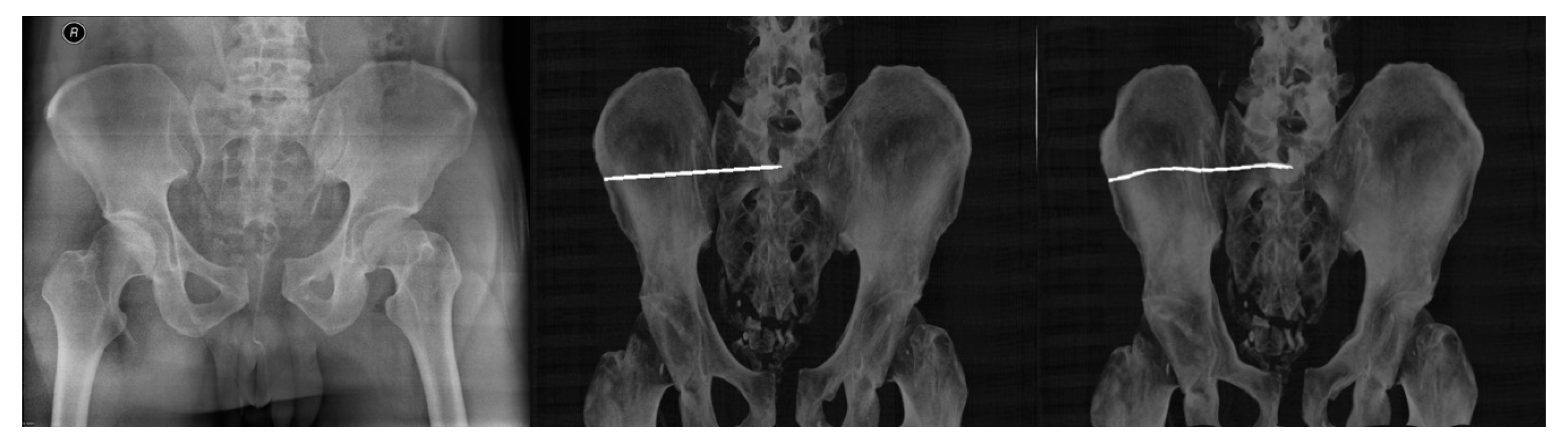 Jcm 12 02138 g007 Jcm 12 02138 g007