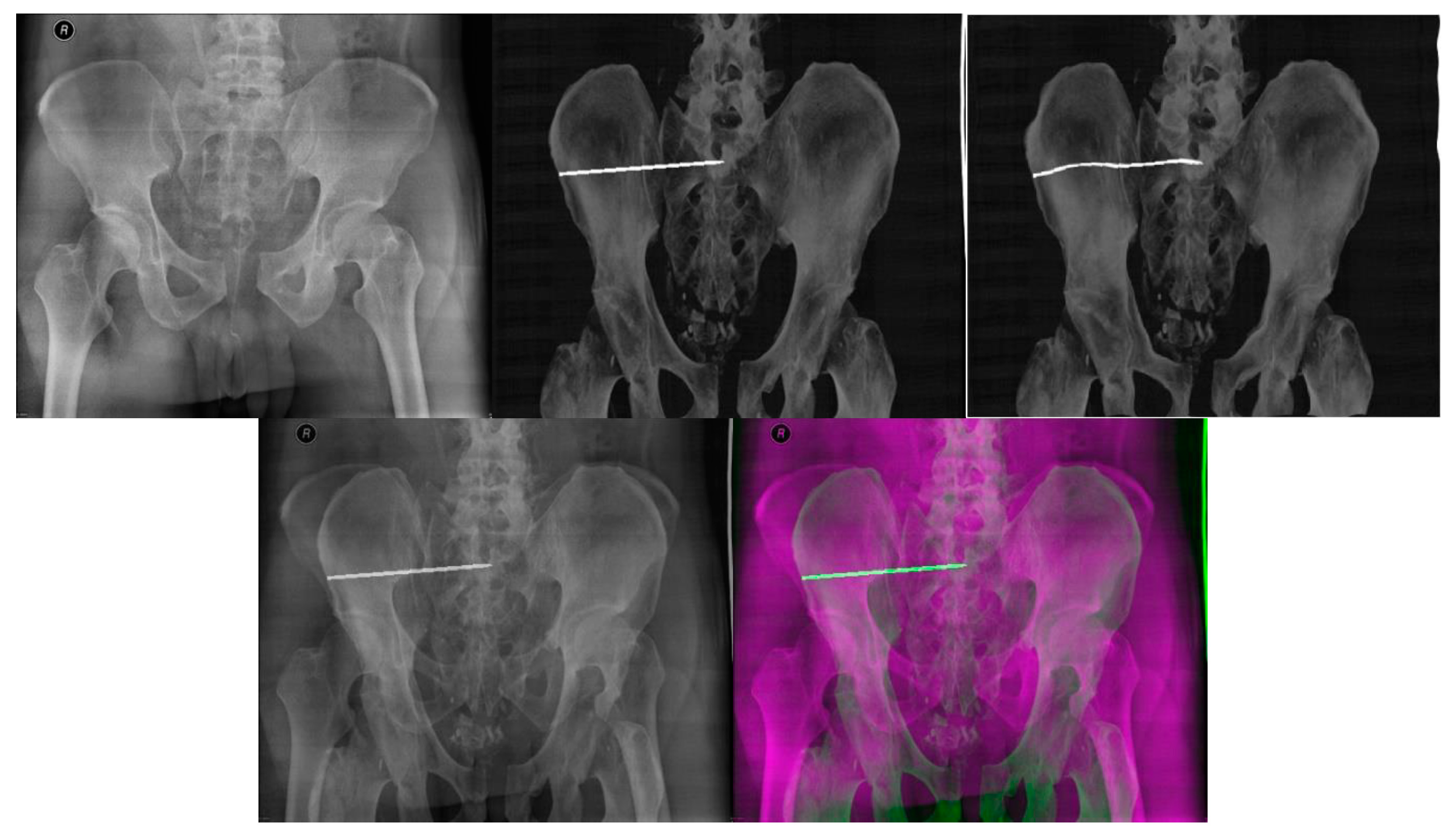 Jcm 12 02138 g008 Jcm 12 02138 g008