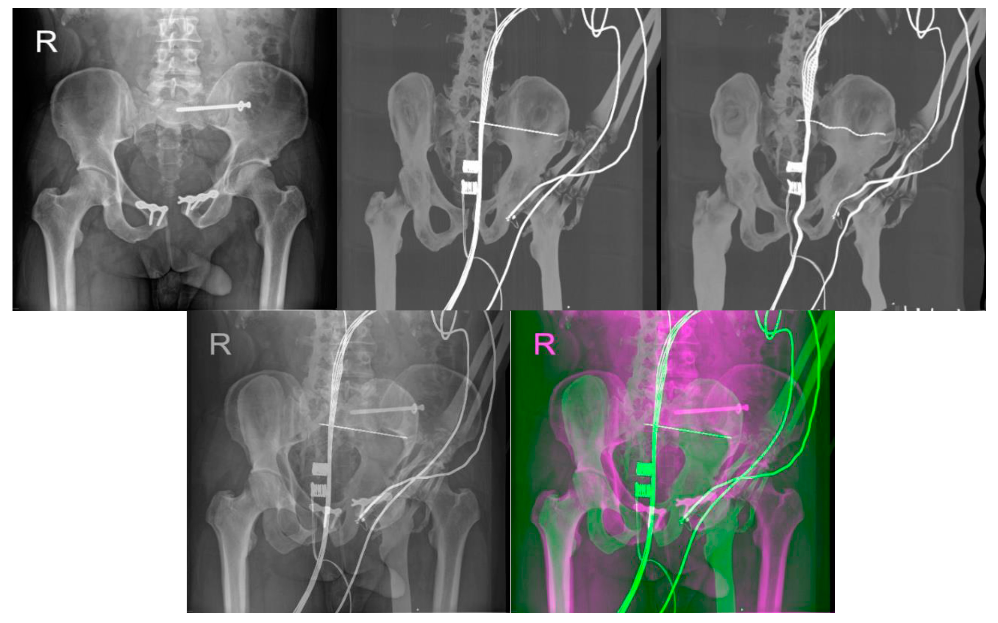 Jcm 12 02138 g009 Jcm 12 02138 g009