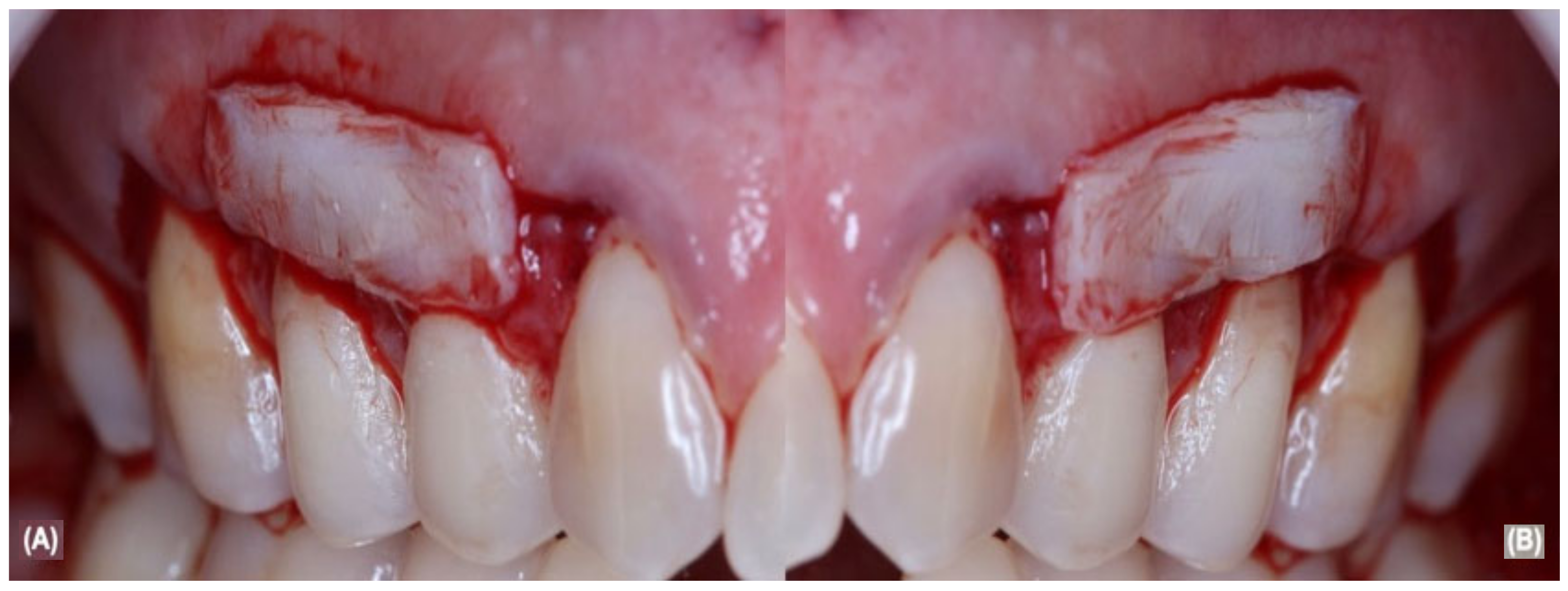 Jcm 12 02349 g002 Jcm 12 02349 g002