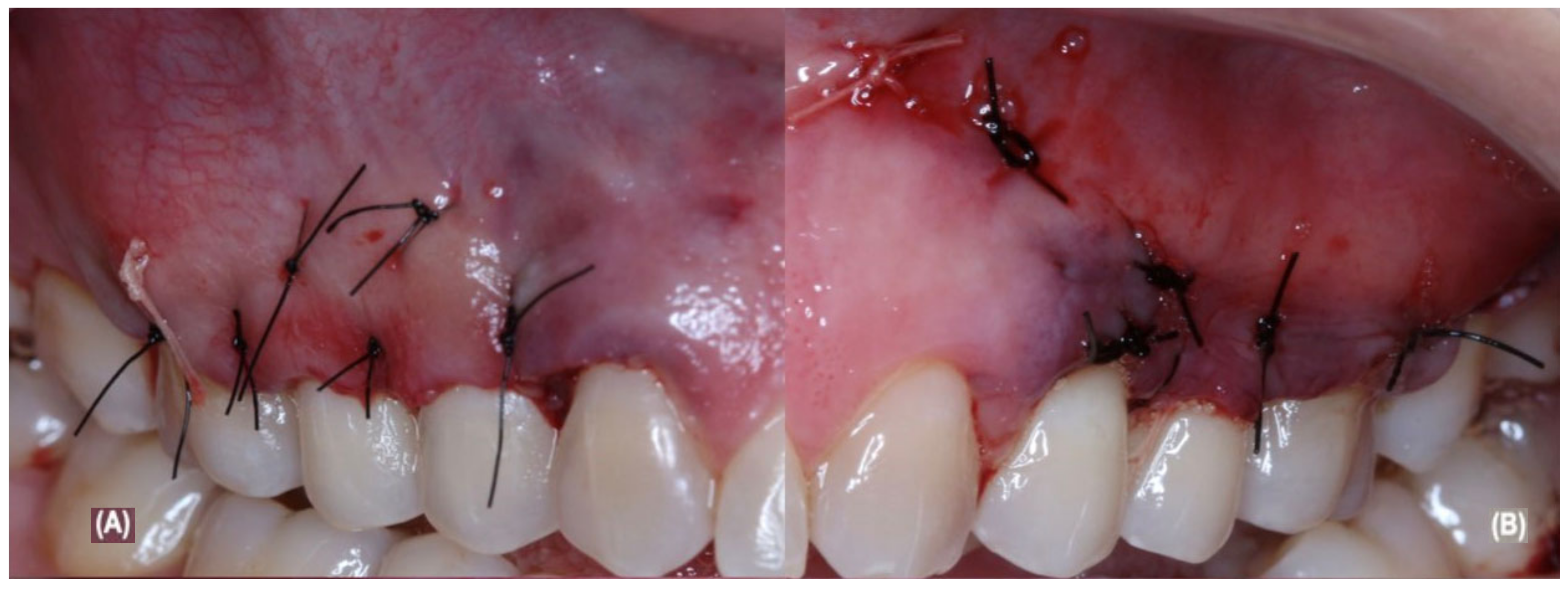 Jcm 12 02349 g003 Jcm 12 02349 g003