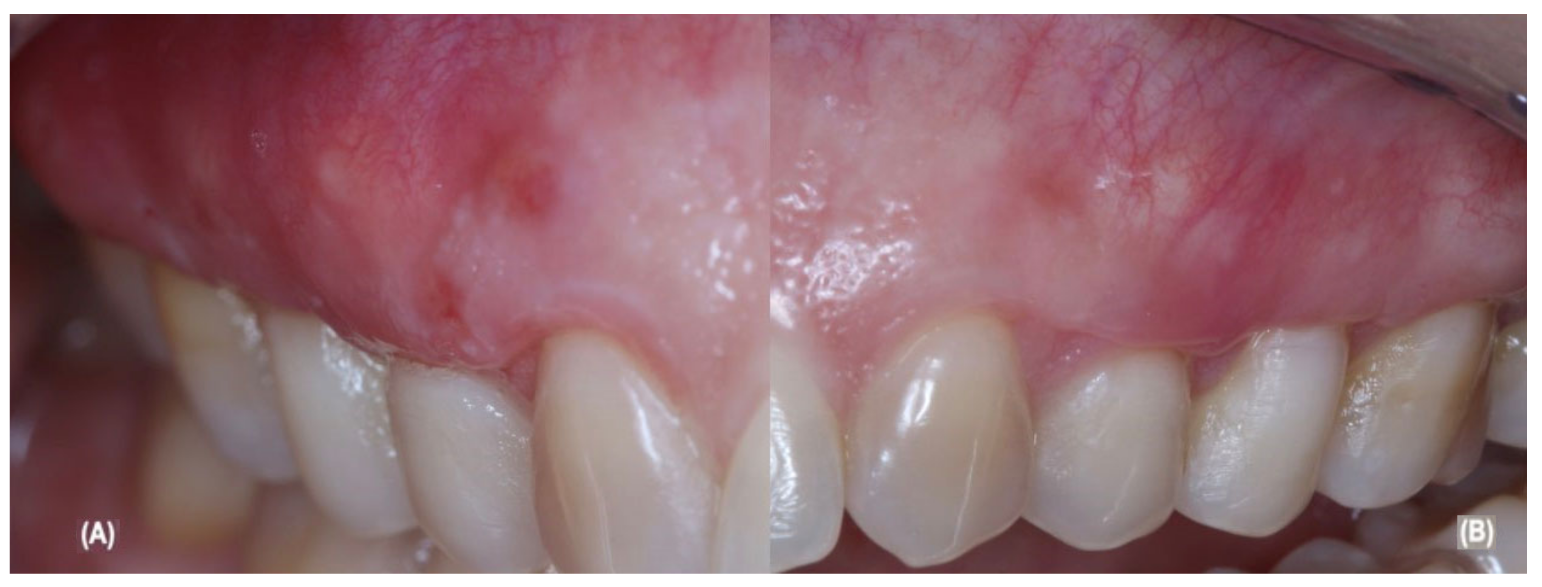 Jcm 12 02349 g004 Jcm 12 02349 g004