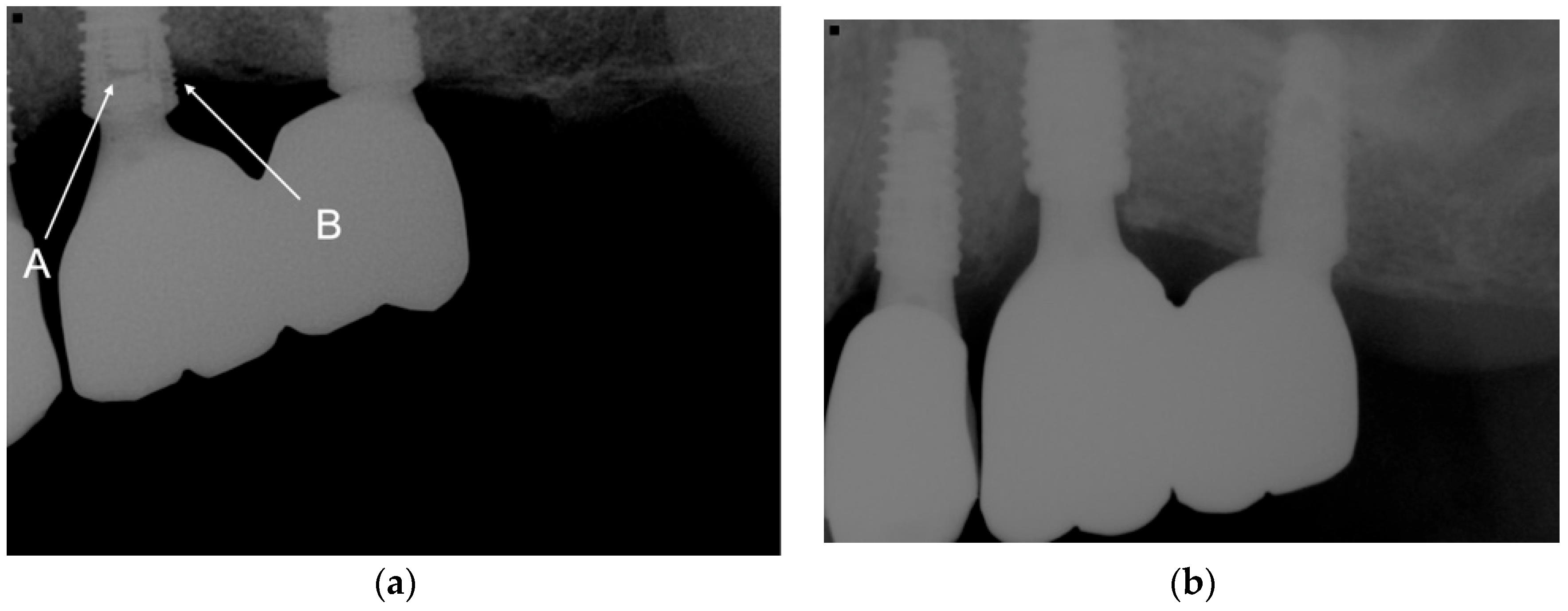 Jcm 12 02425 g002 Jcm 12 02425 g002