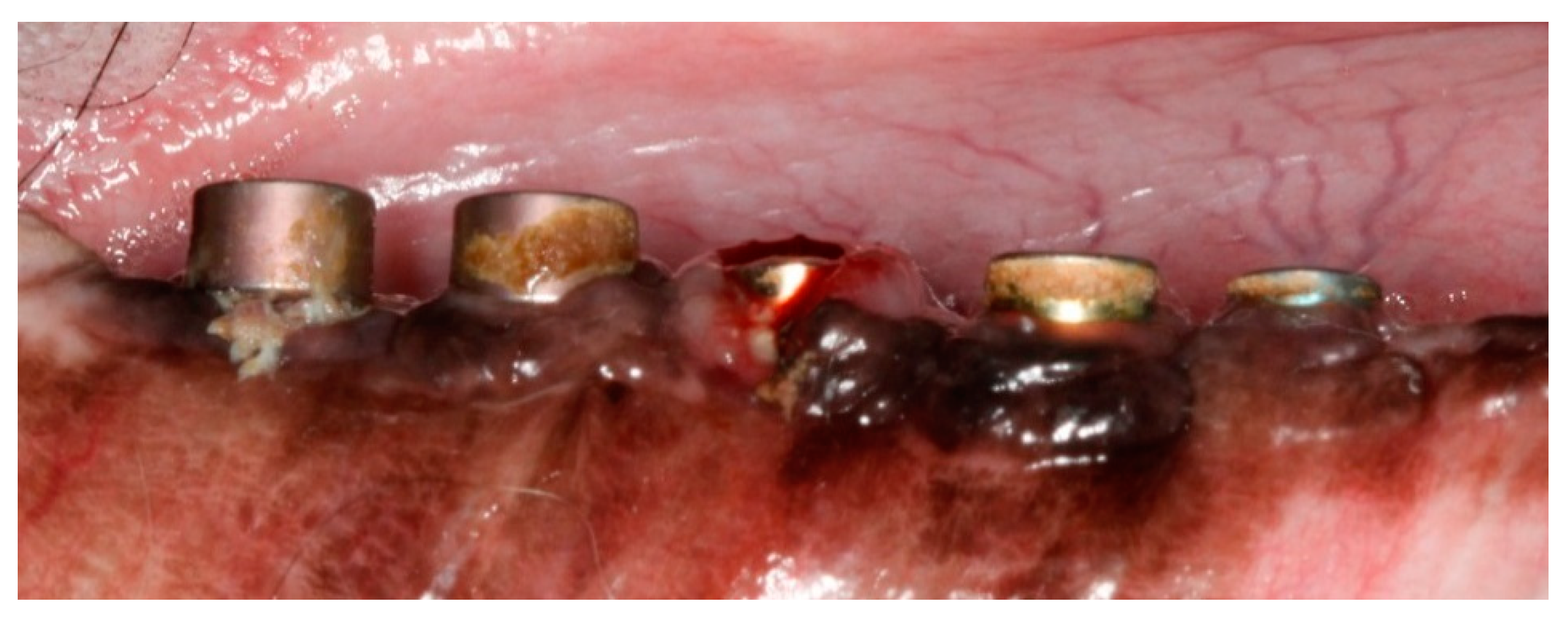 Jcm 12 02462 g001 Jcm 12 02462 g001