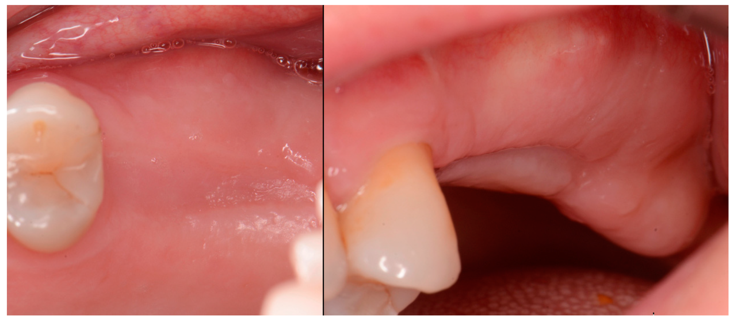 Jcm 12 02485 g002 Jcm 12 02485 g002