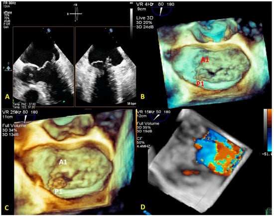 PDF) Novelties in 3D Transthoracic Echocardiography