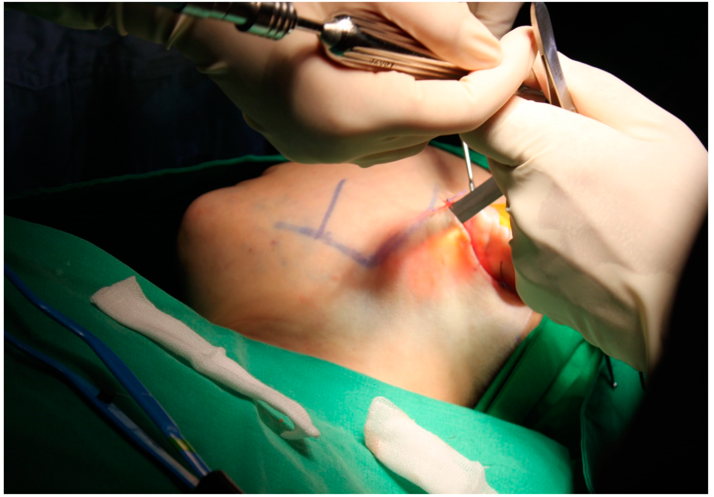 Jcm 12 02641 g002 Jcm 12 02641 g002