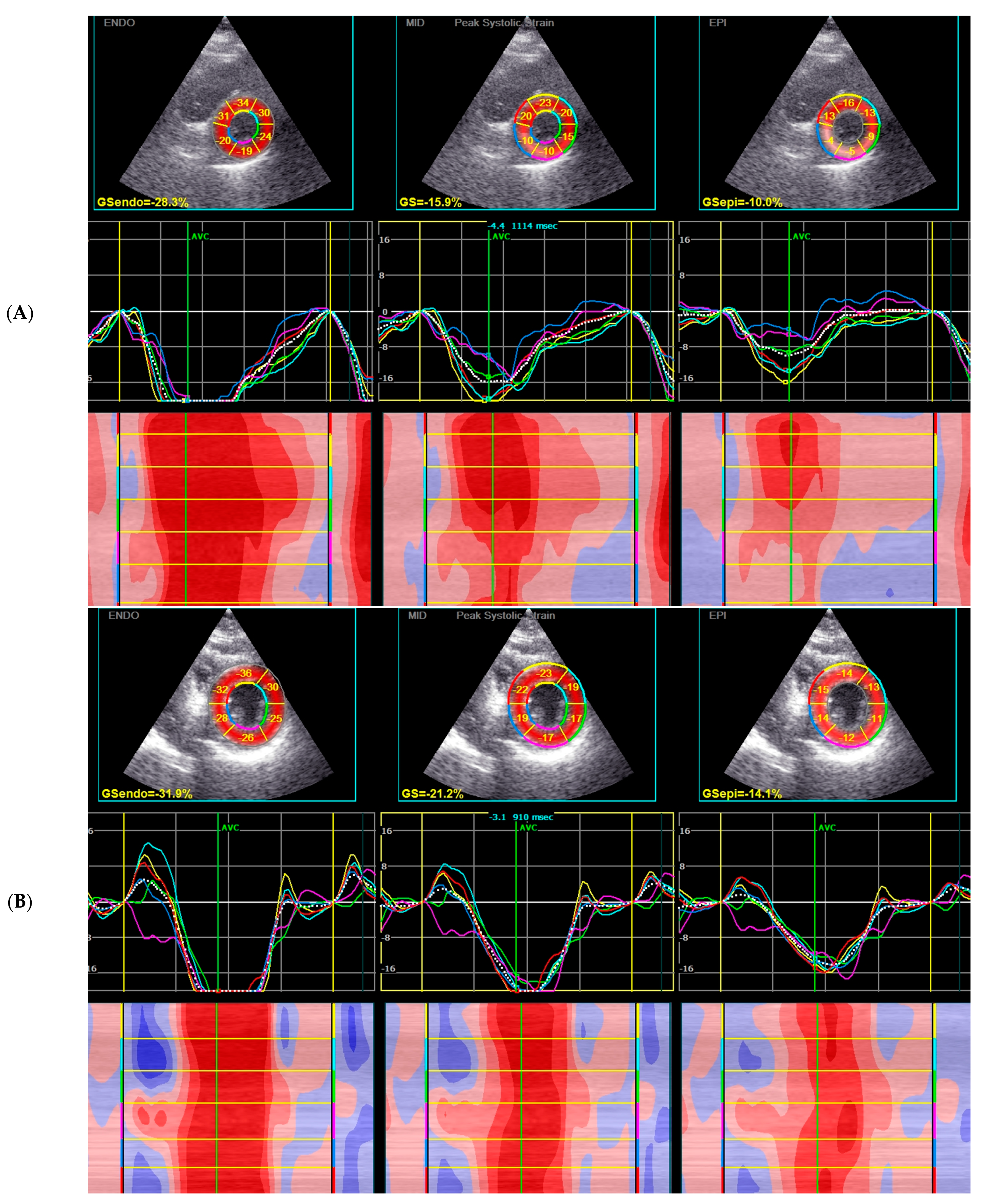 Jcm 12 02777 g005 Jcm 12 02777 g005