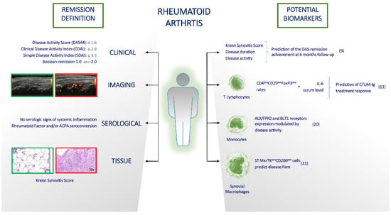 JCM | Free Full-Text | Rheumatoid Arthritis From Easy To Complex ...