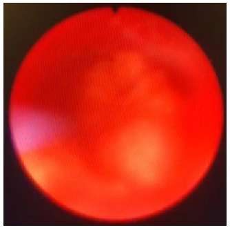 Jcm 12 02820 i005 Jcm 12 02820 i005