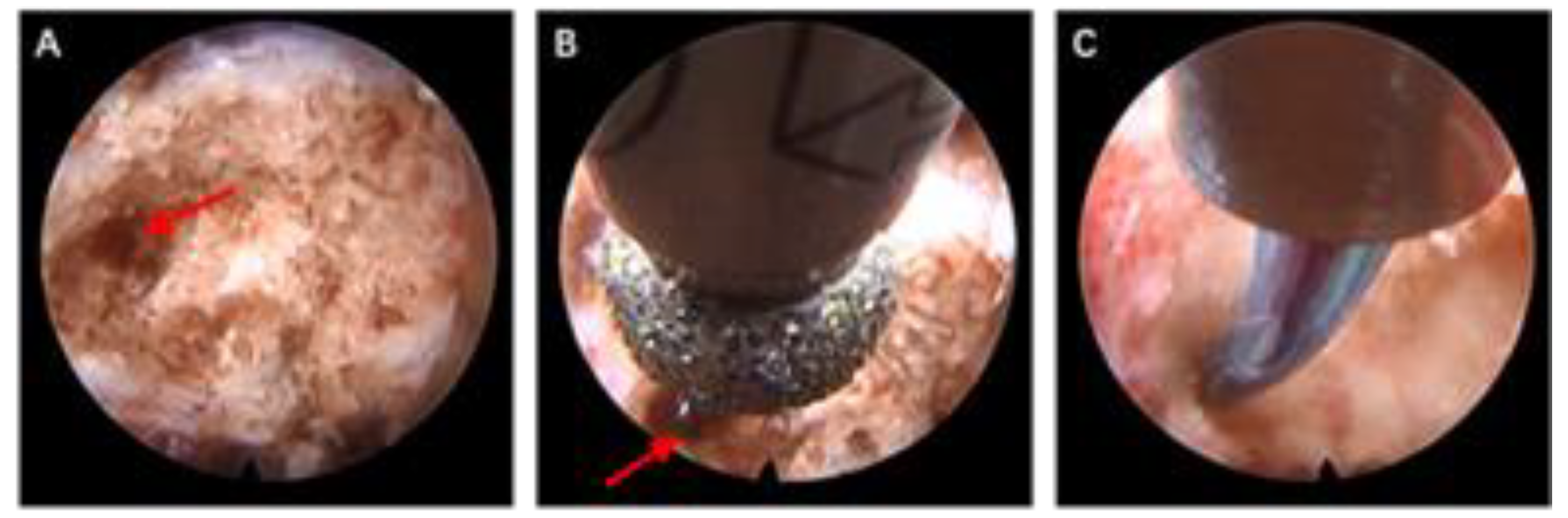 Jcm 12 02990 g002a Jcm 12 02990 g002a