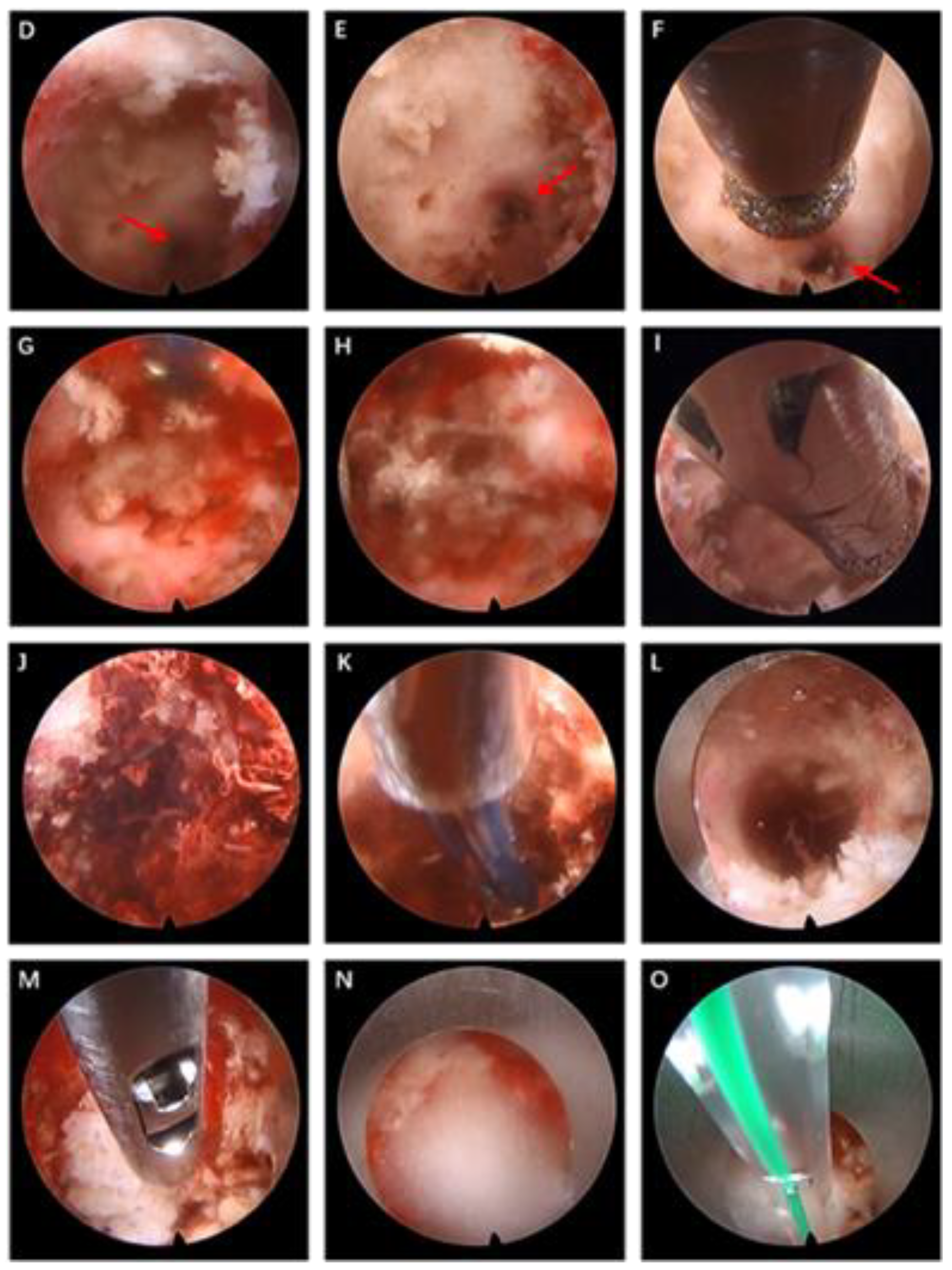 Jcm 12 02990 g002b Jcm 12 02990 g002b