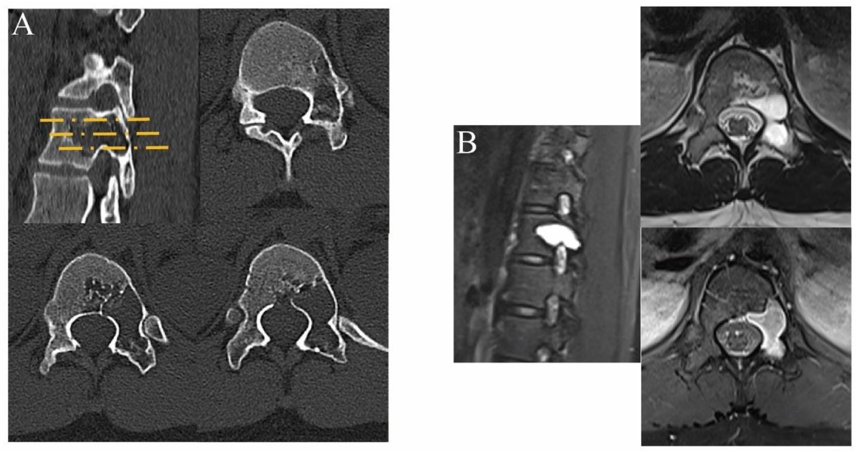 Jcm 12 02990 g004 Jcm 12 02990 g004