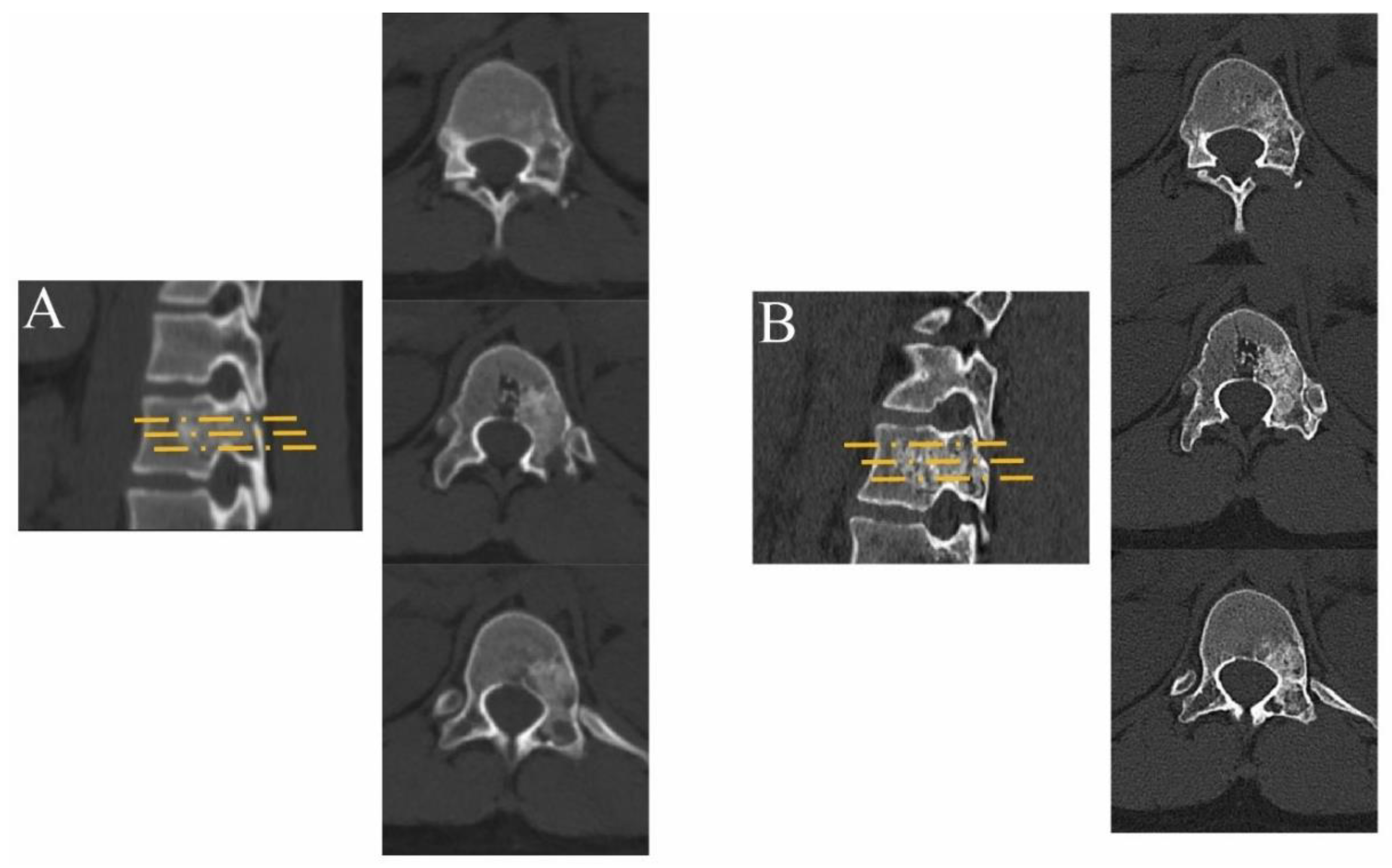 Jcm 12 02990 g006 Jcm 12 02990 g006