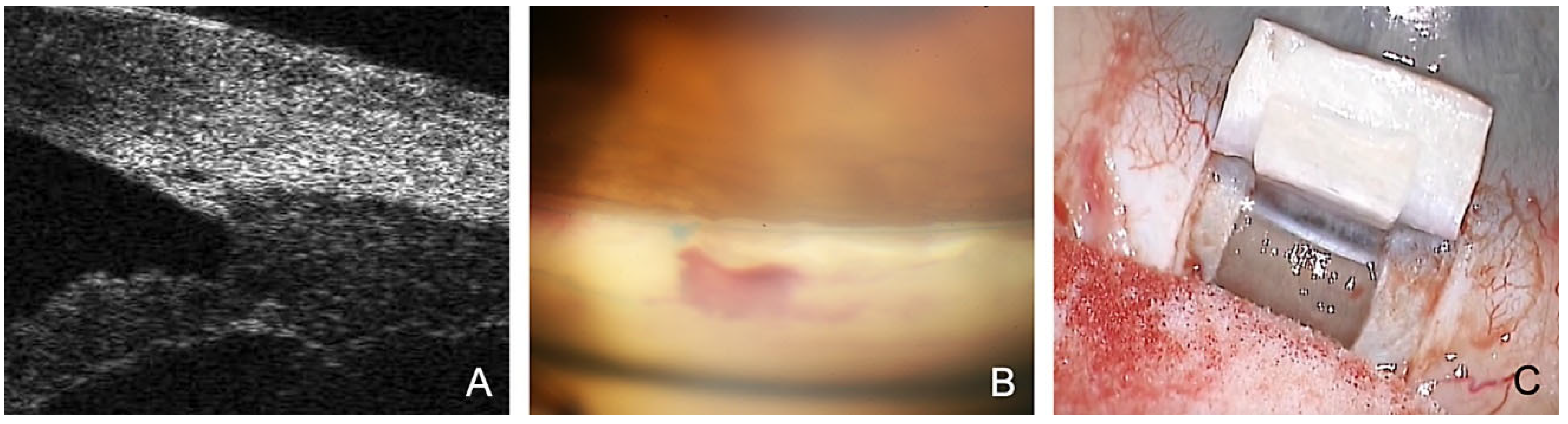 Jcm 12 03031 g001 Jcm 12 03031 g001