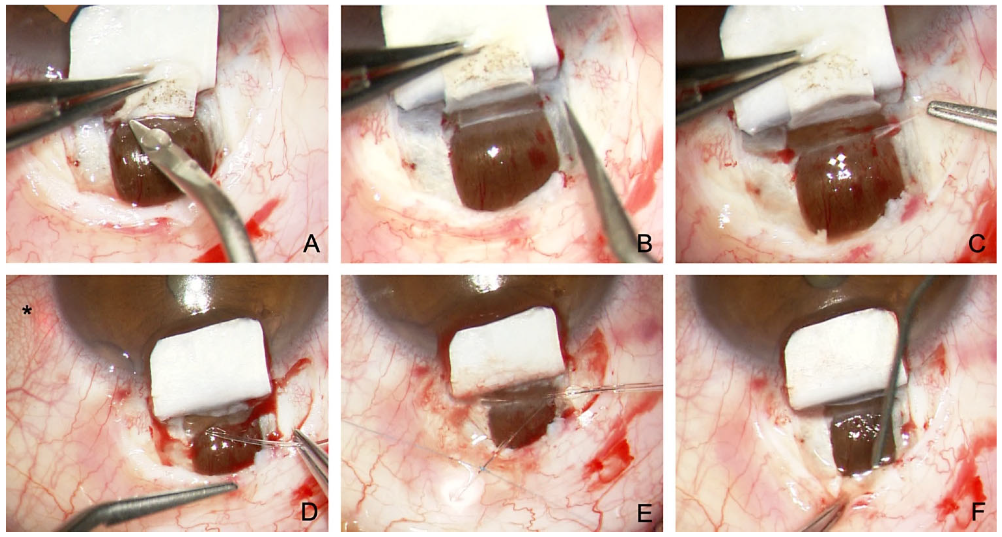 Jcm 12 03031 g005 Jcm 12 03031 g005