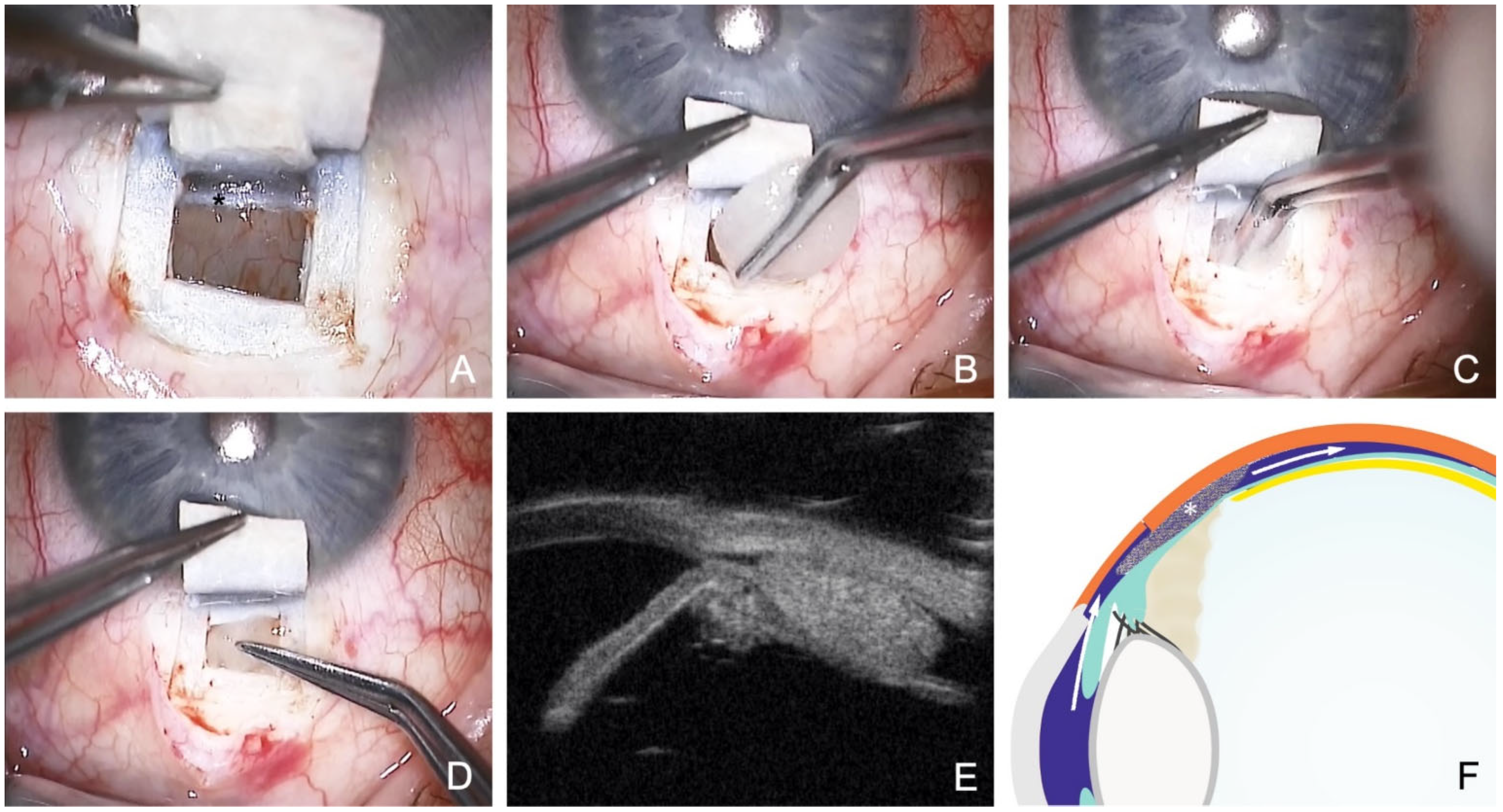 Jcm 12 03031 g006 Jcm 12 03031 g006
