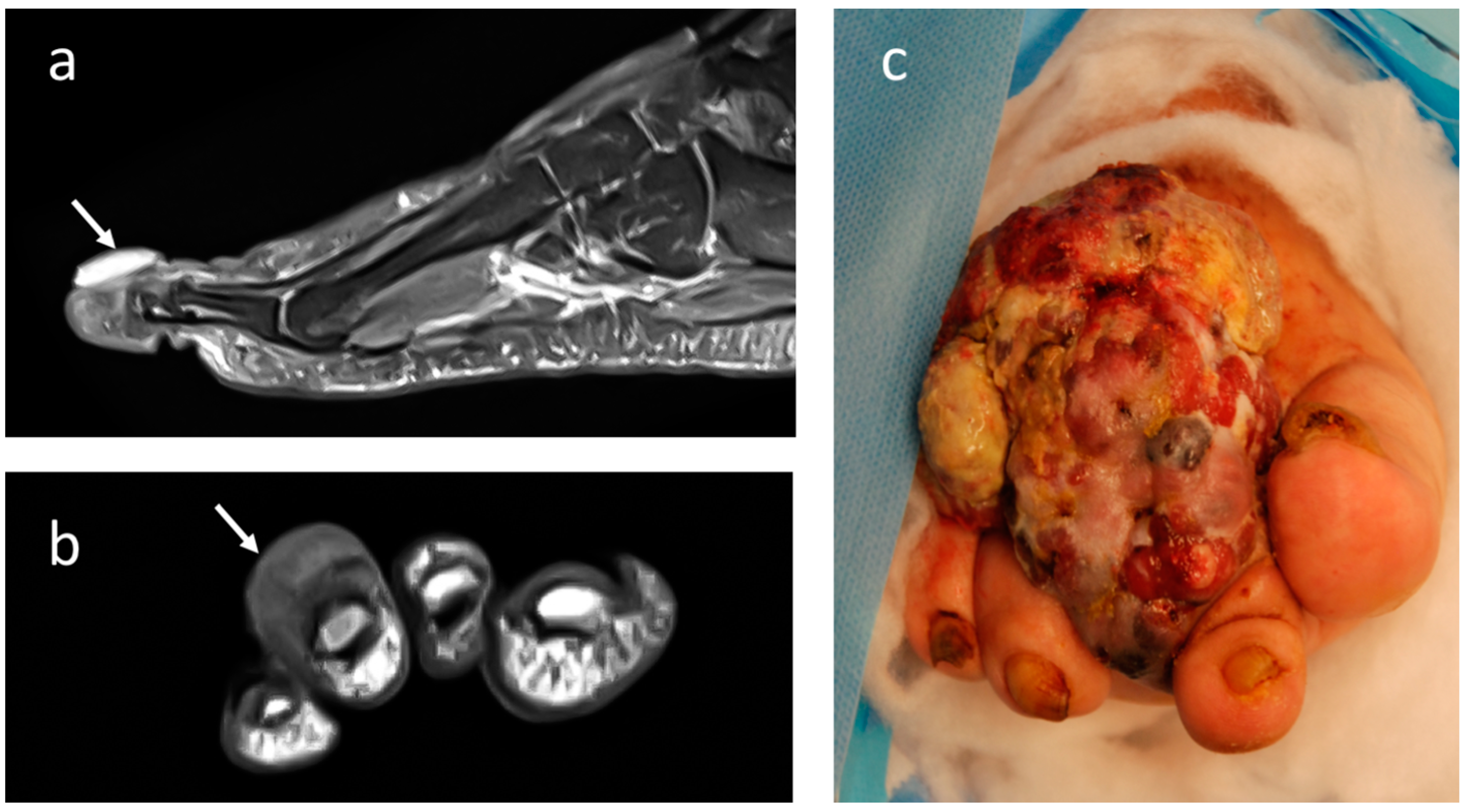 Jcm 12 03038 g004 Jcm 12 03038 g004
