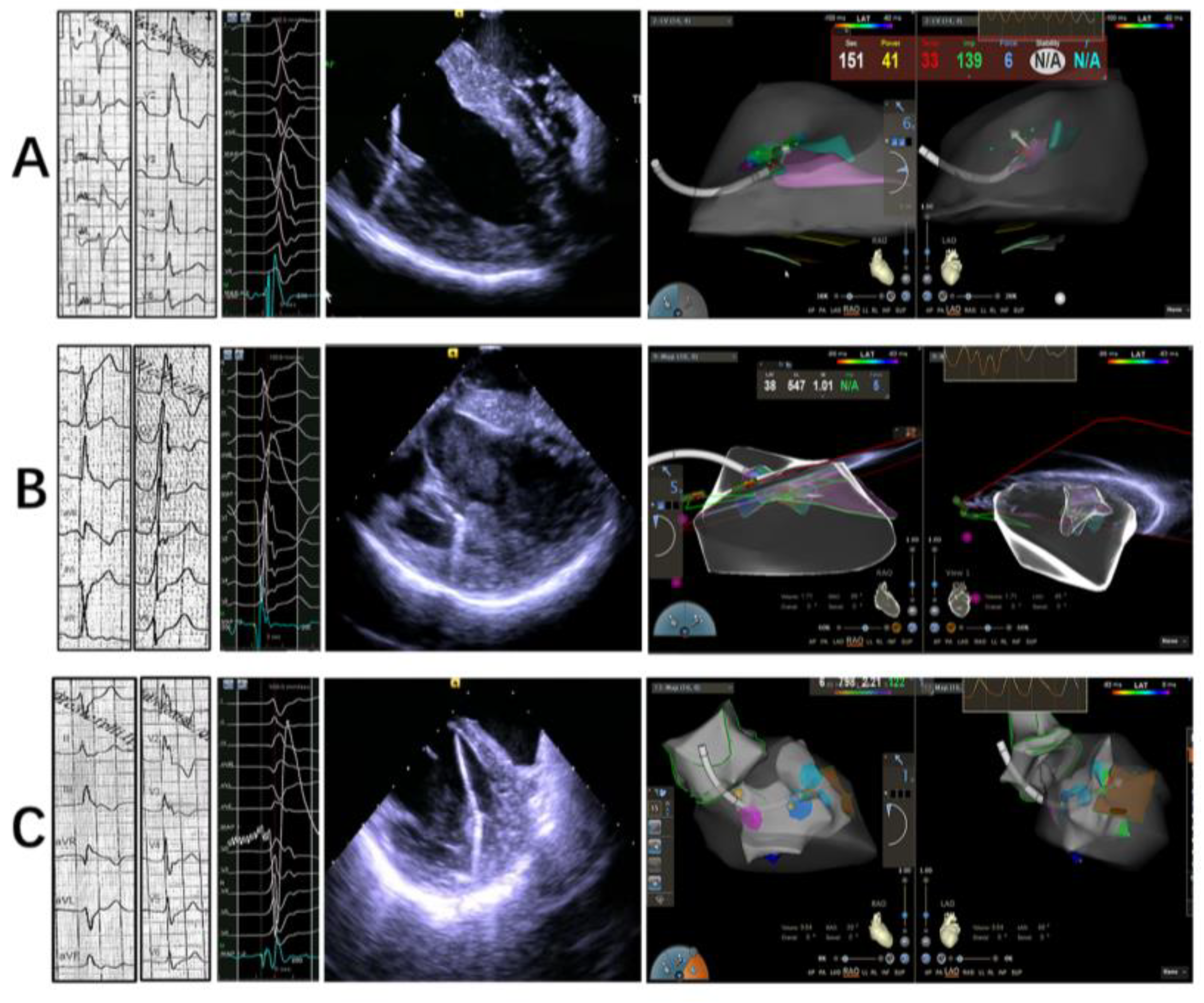 Jcm 12 03154 g004 Jcm 12 03154 g004