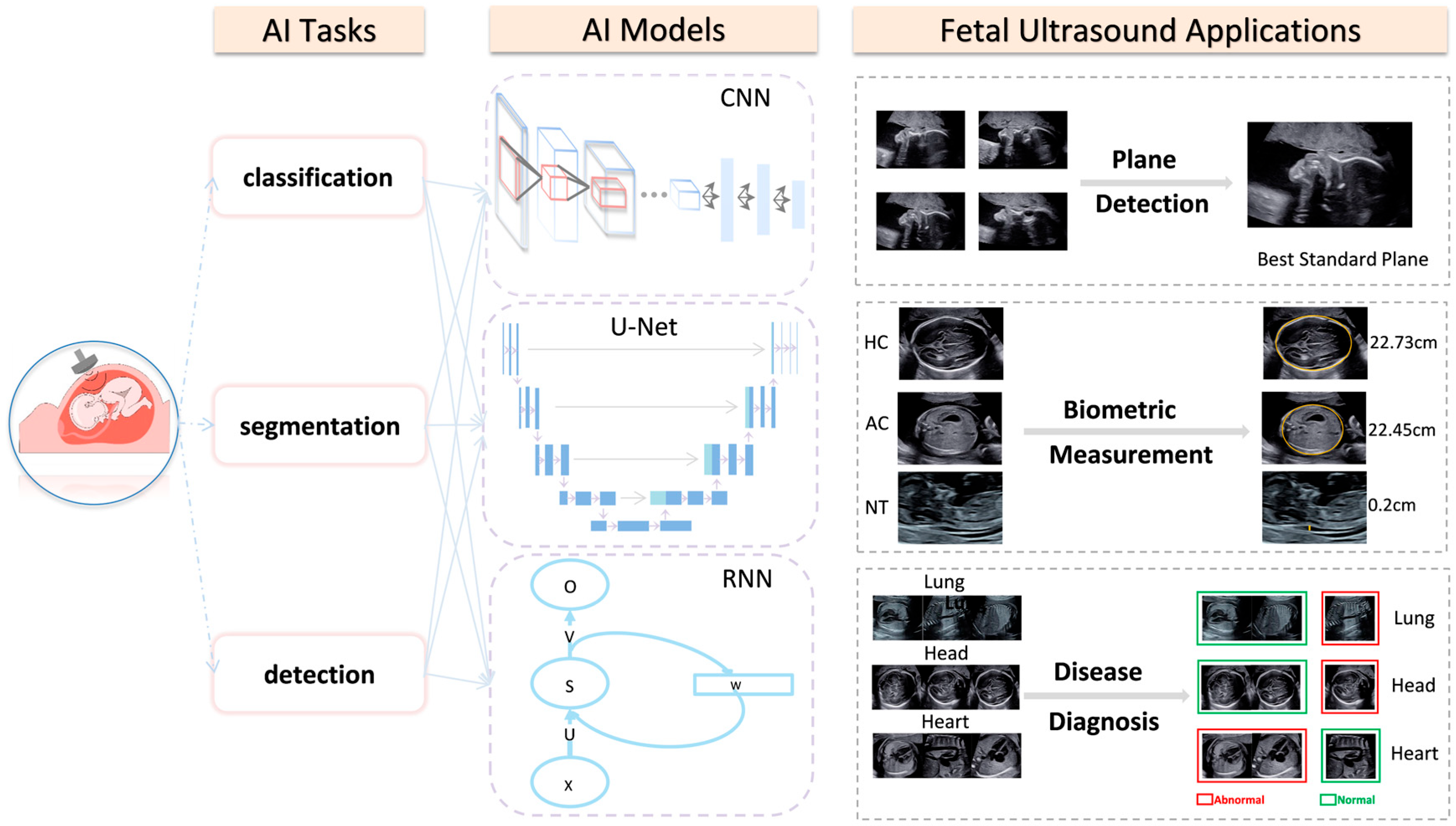 JCM | Free Full-Text | Application and Progress of Artificial Intelligence  in Fetal Ultrasound