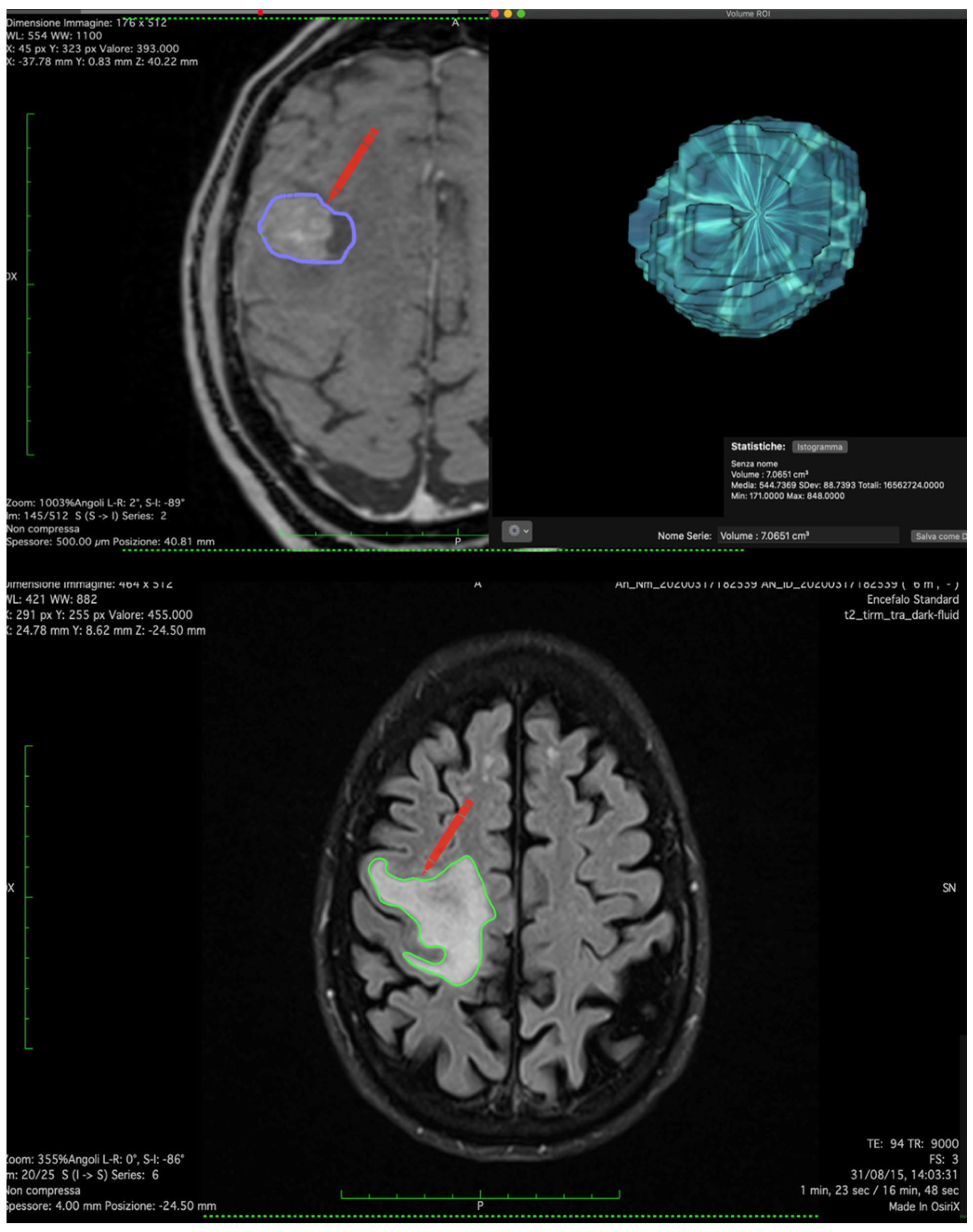 Jcm 12 03372 g001 Jcm 12 03372 g001