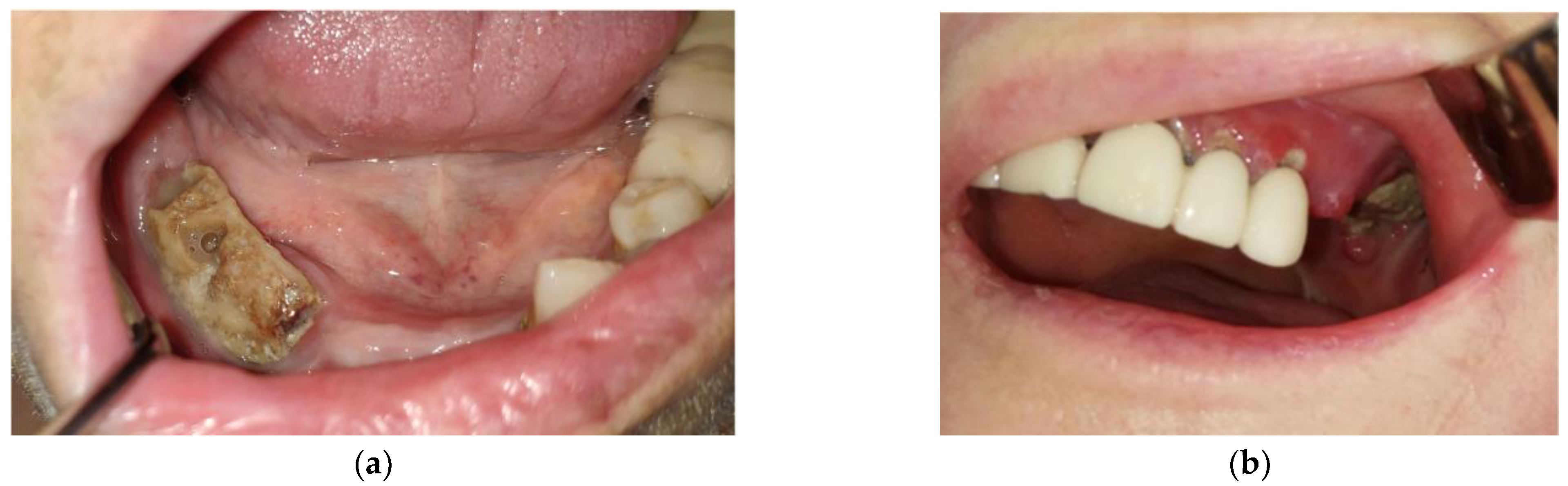 Jcm 12 03383 g003 Jcm 12 03383 g003