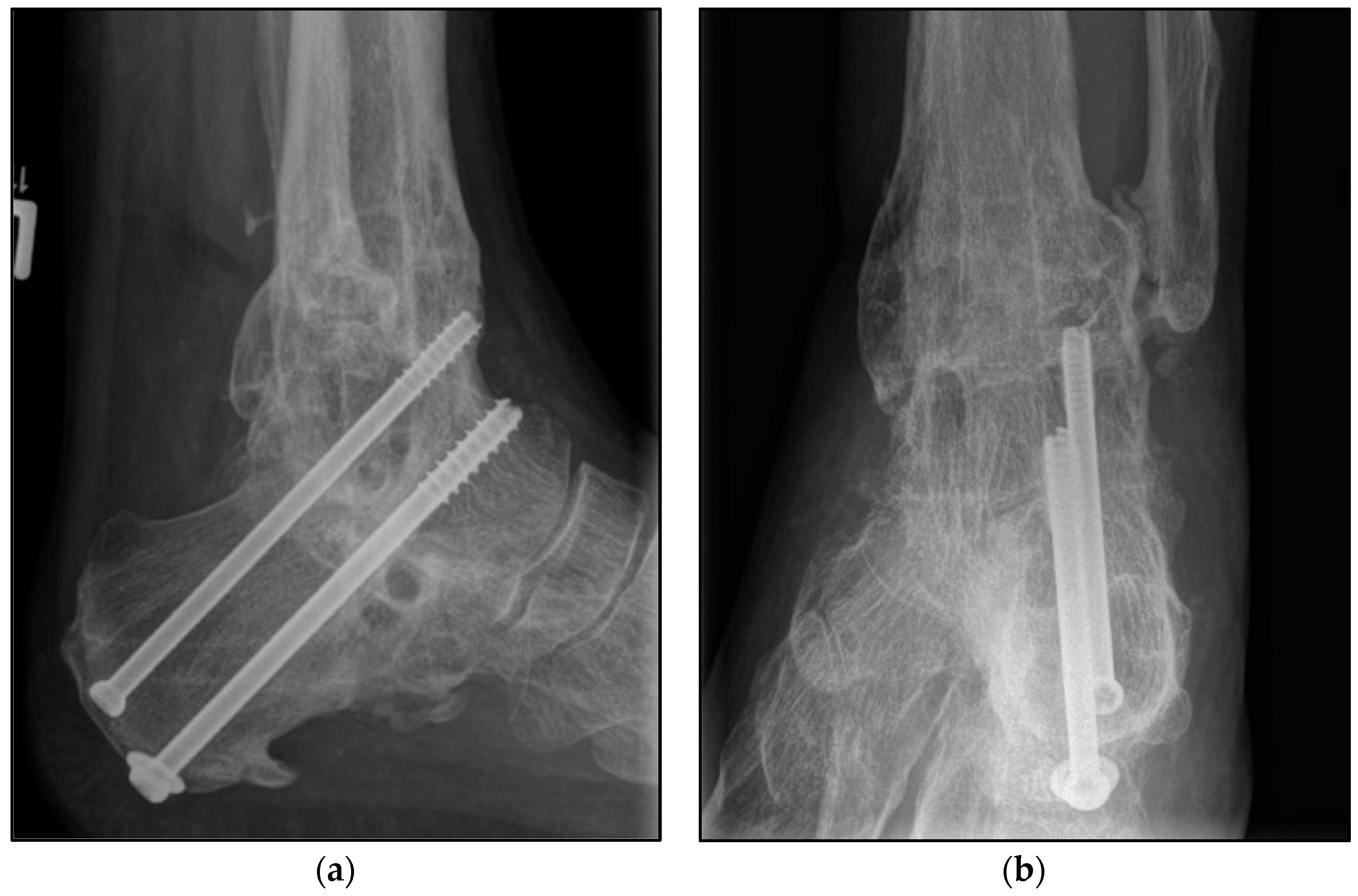 Jcm 12 03422 g002 Jcm 12 03422 g002