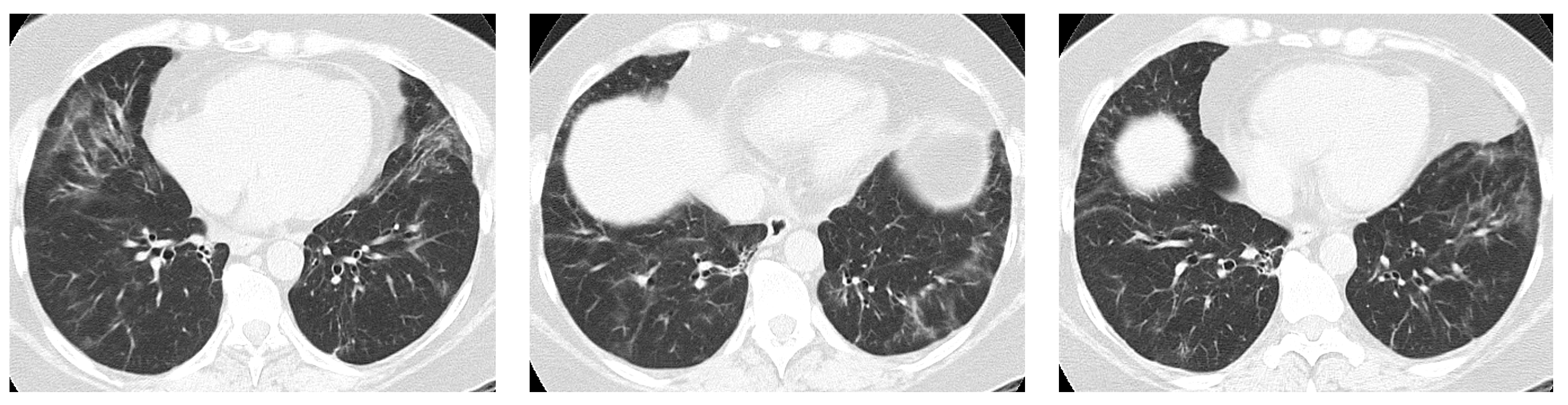 Jcm 12 03428 g003 Jcm 12 03428 g003