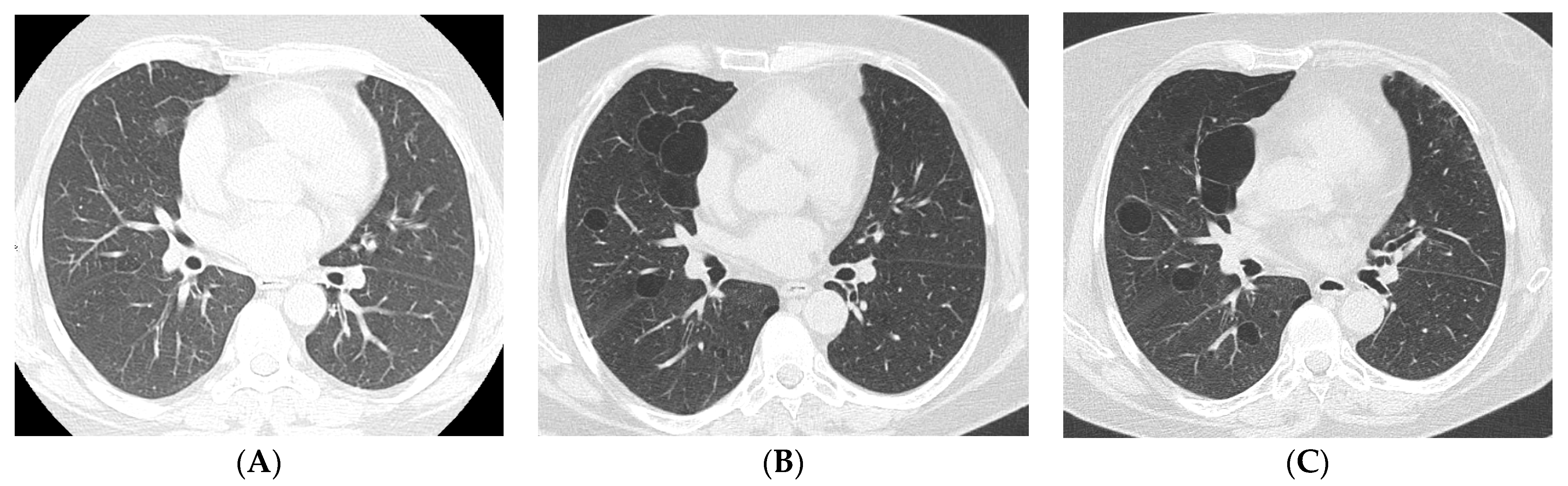 Jcm 12 03428 g004 Jcm 12 03428 g004