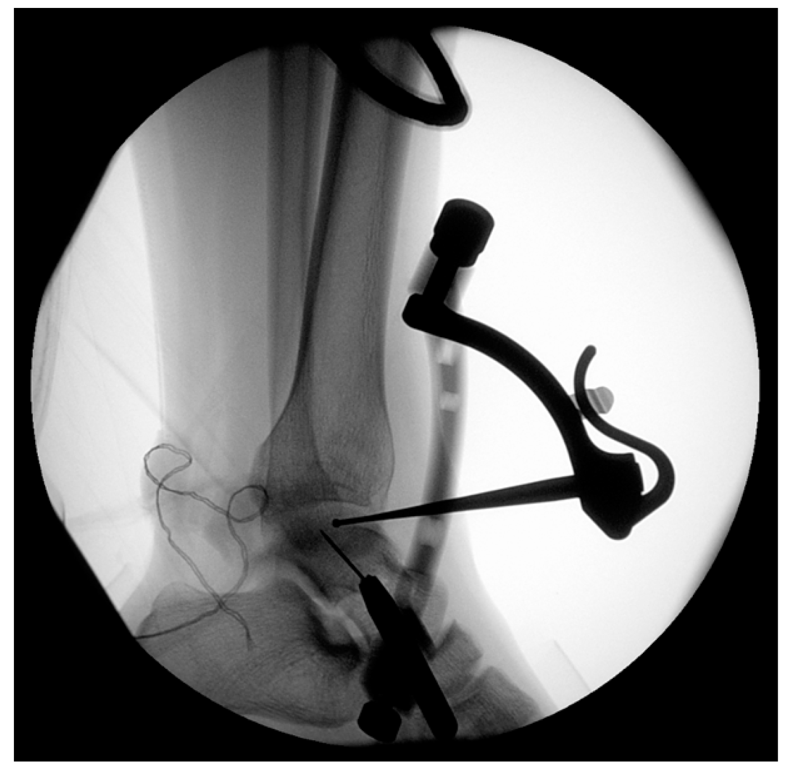 Jcm 12 03431 g002 Jcm 12 03431 g002