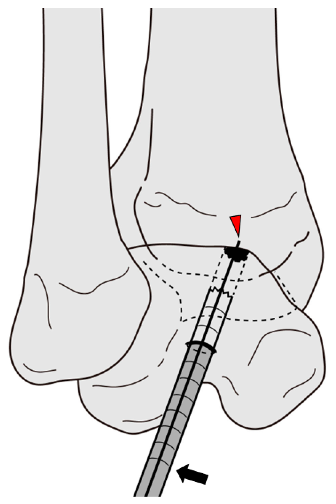 Jcm 12 03431 g004 Jcm 12 03431 g004