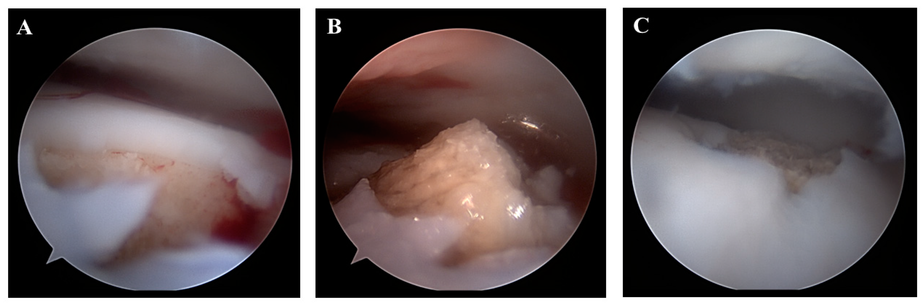 Jcm 12 03431 g006 Jcm 12 03431 g006