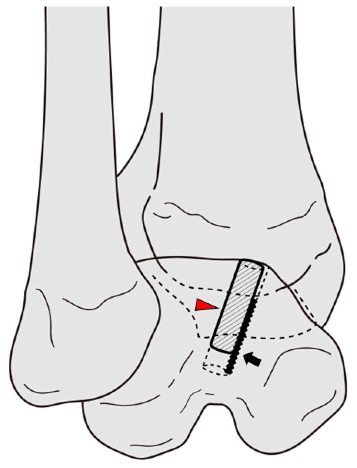 Jcm 12 03431 g007 Jcm 12 03431 g007