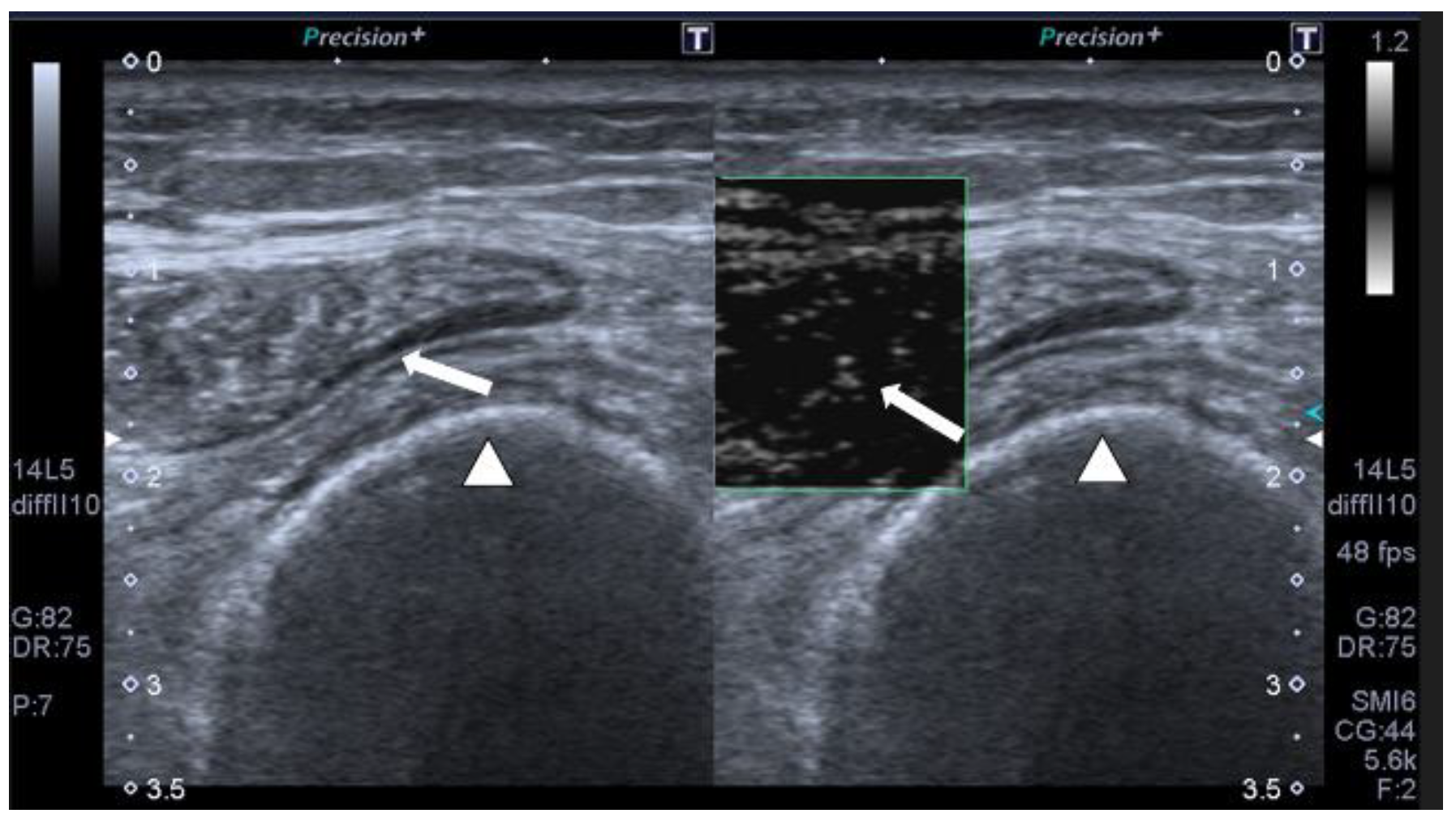 Jcm 12 03473 g002 Jcm 12 03473 g002