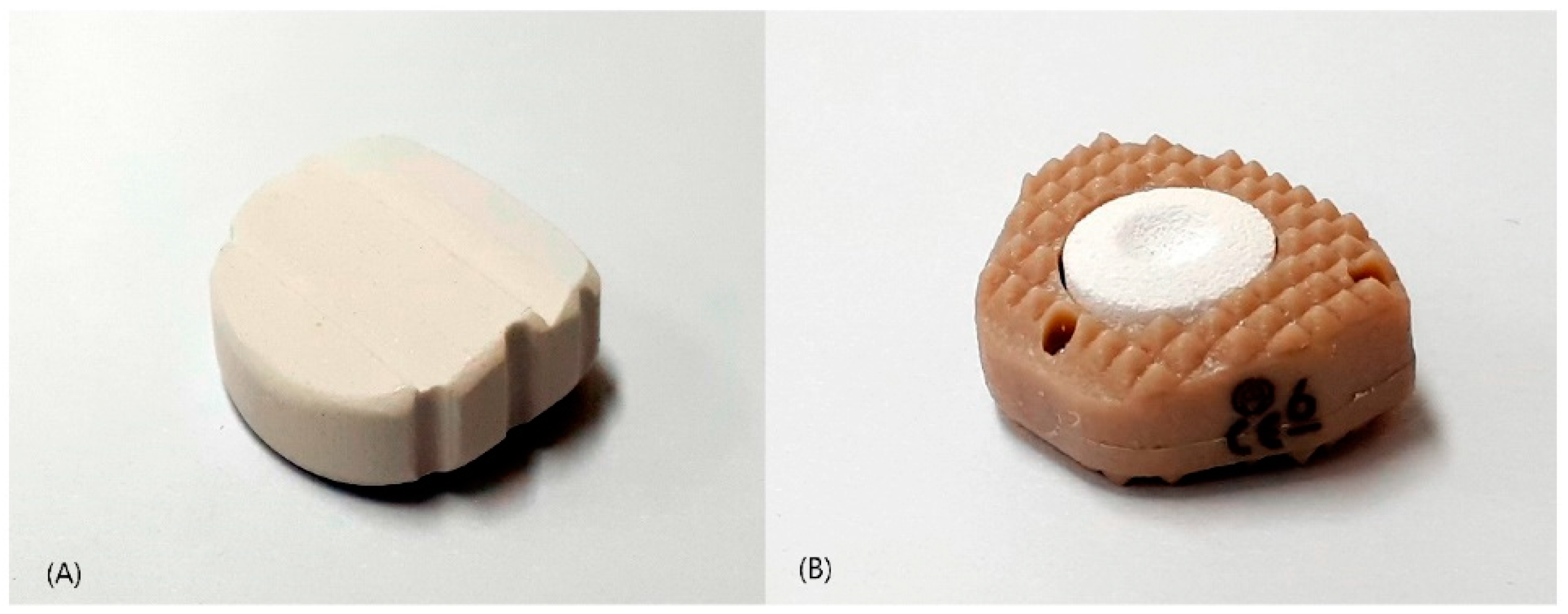 JCM | Free Full-Text | Anterior Cervical Discectomy and Fusion Performed  Using a CaO-SiO2-P2O5-B2O3 Bioactive Glass Ceramic or Polyetheretherketone  Cage Filled with Hydroxyapatite/&beta;-Tricalcium Phosphate: A Prospective  Randomized Controlled Trial