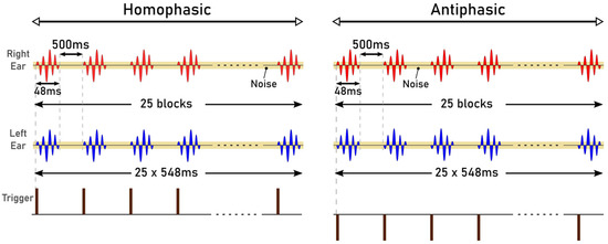 Automated cortical auditory evoked potentials threshold estimation in  neonates