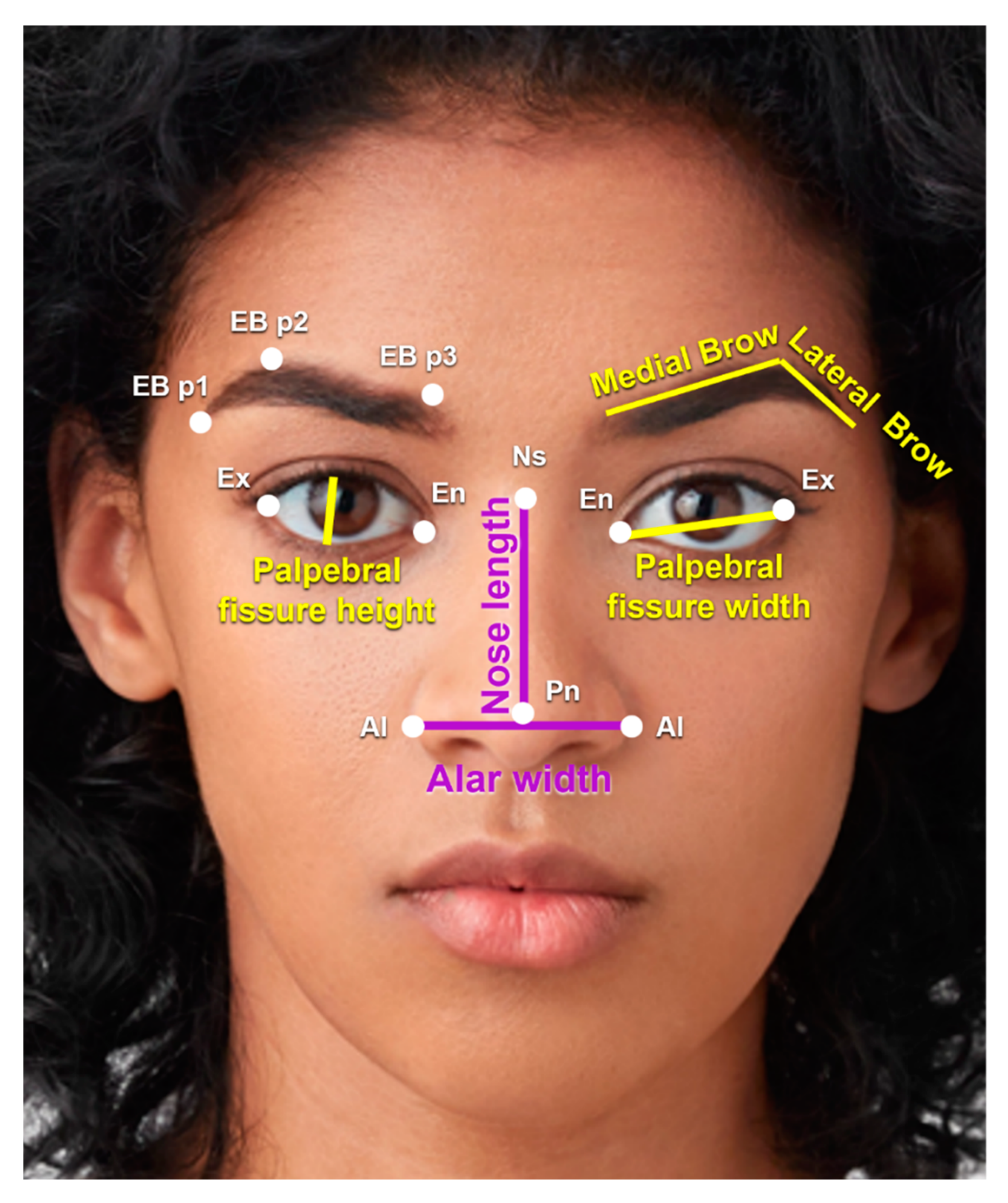 What is an Eye canthal Tilt? Why is a positive tilt more attractive than a  negative tilt among females? - PinkMirror Blog