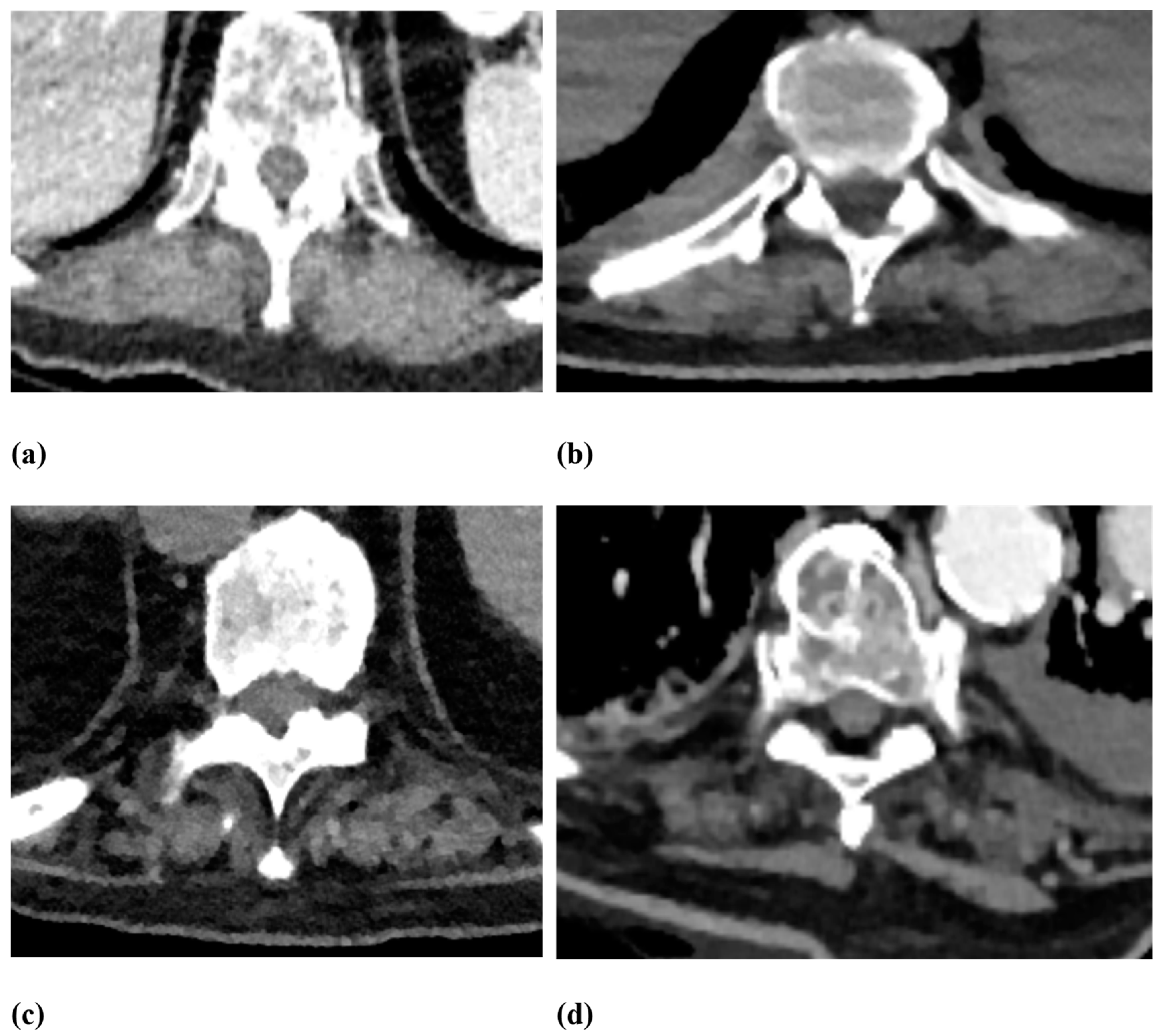 Jcm 12 04565 g004 Jcm 12 04565 g004