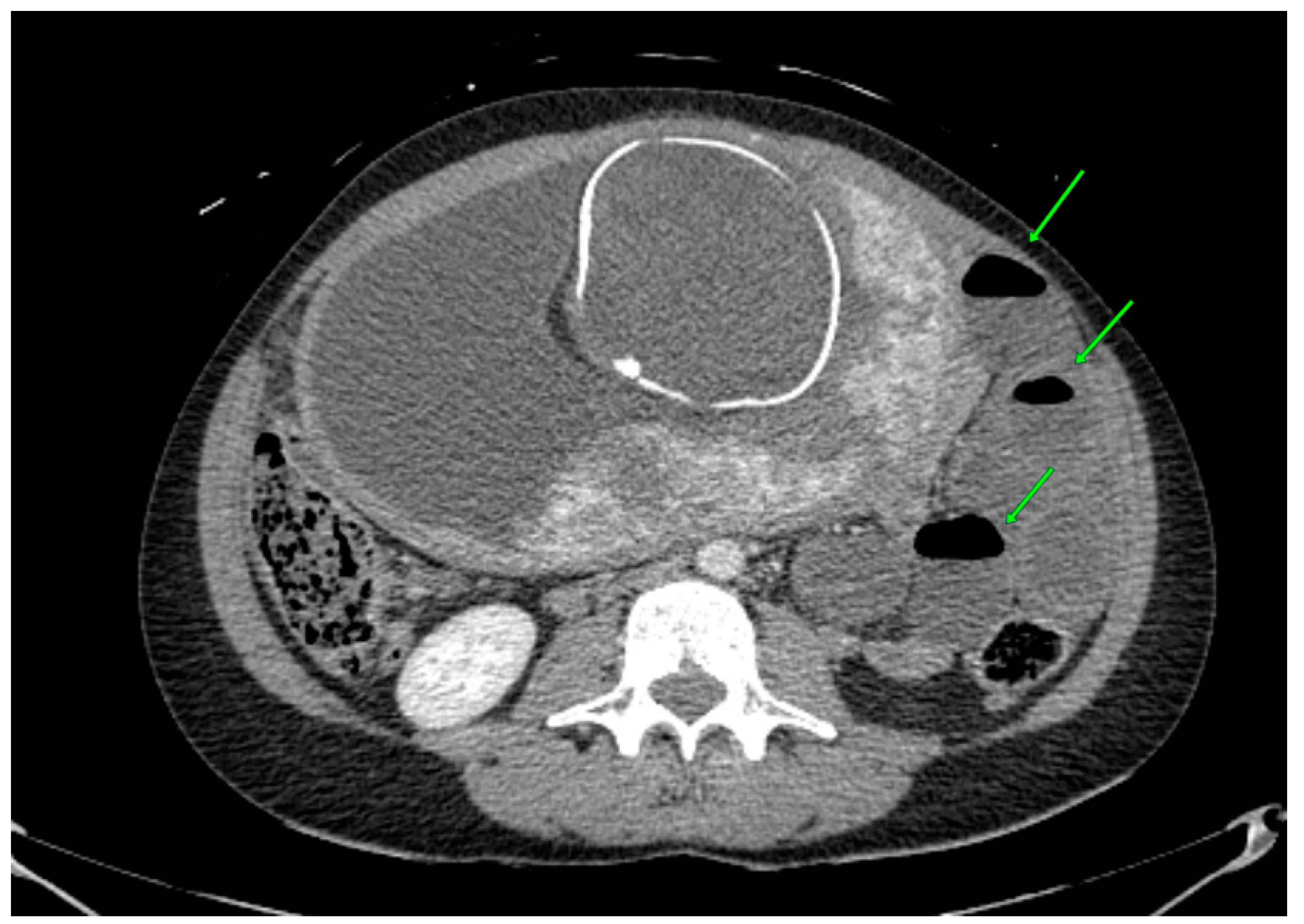 Jcm 12 04569 g002 Jcm 12 04569 g002