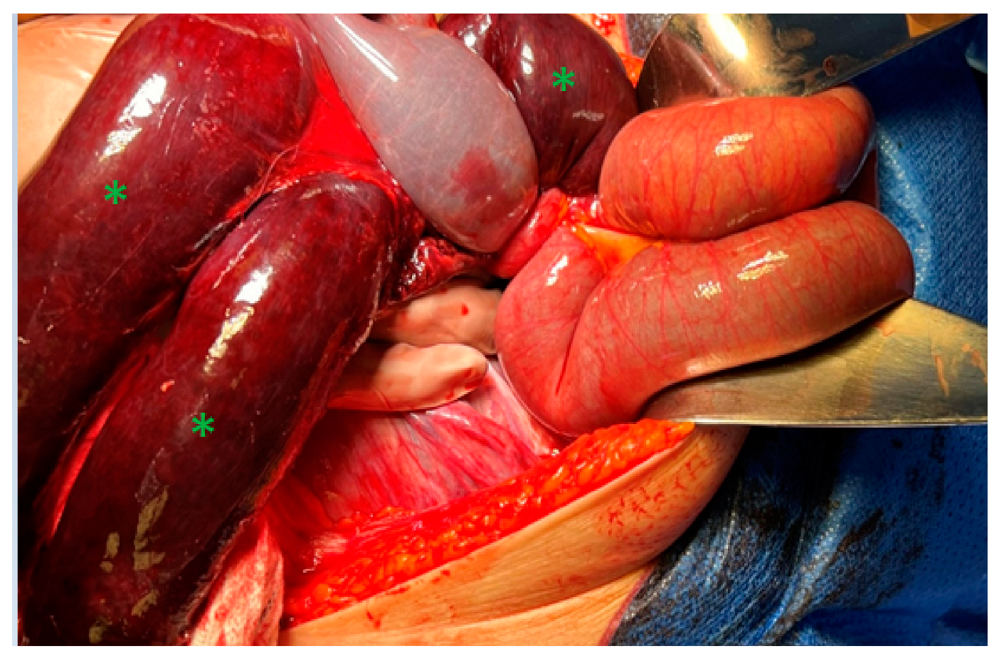 Jcm 12 04569 g003 Jcm 12 04569 g003