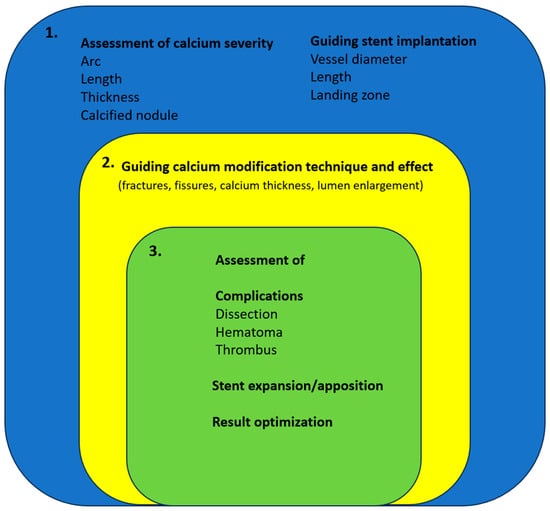 JCM | Free Full-Text | The Role Of Intracoronary Imaging For The ...