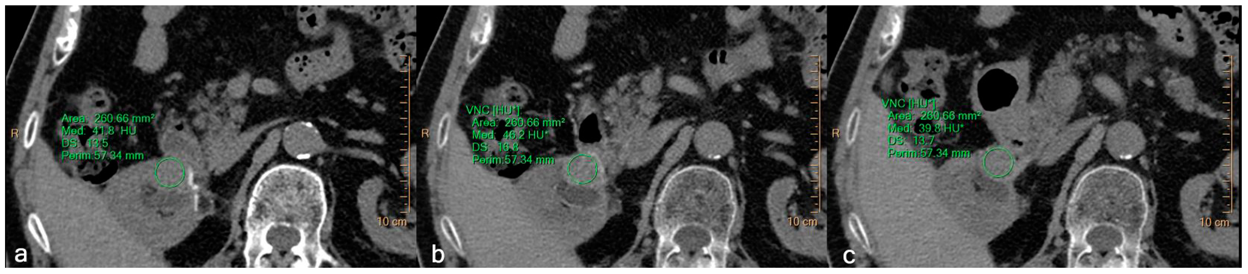 Jcm 12 04718 g007 Jcm 12 04718 g007