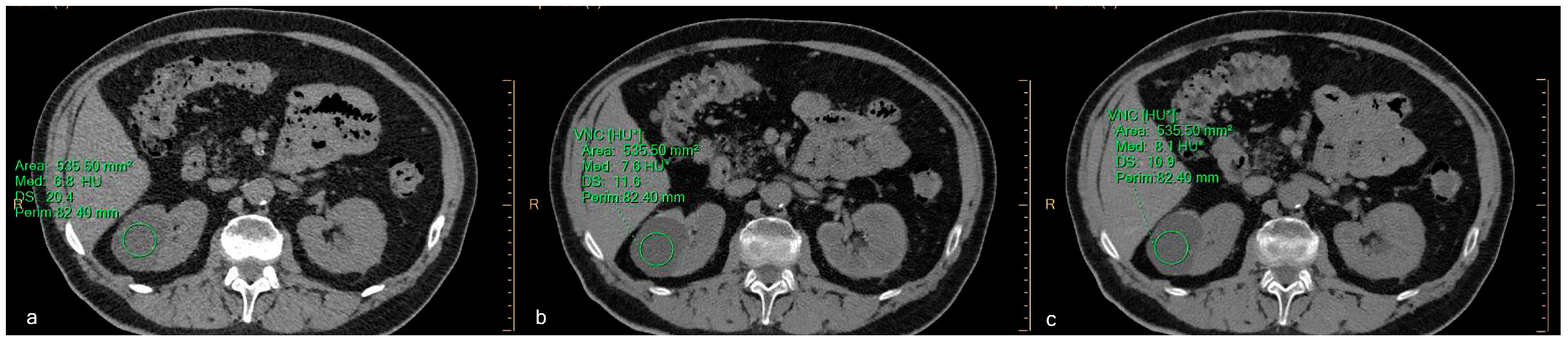 Jcm 12 04718 g008 Jcm 12 04718 g008