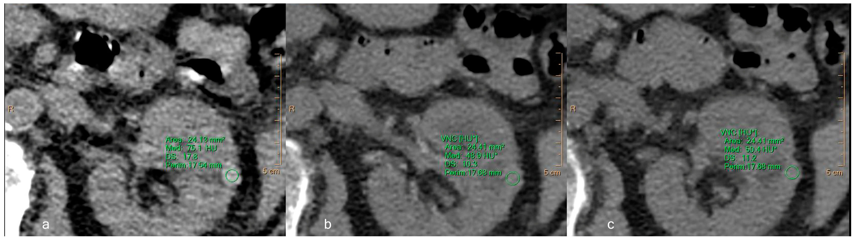 Jcm 12 04718 g009 Jcm 12 04718 g009
